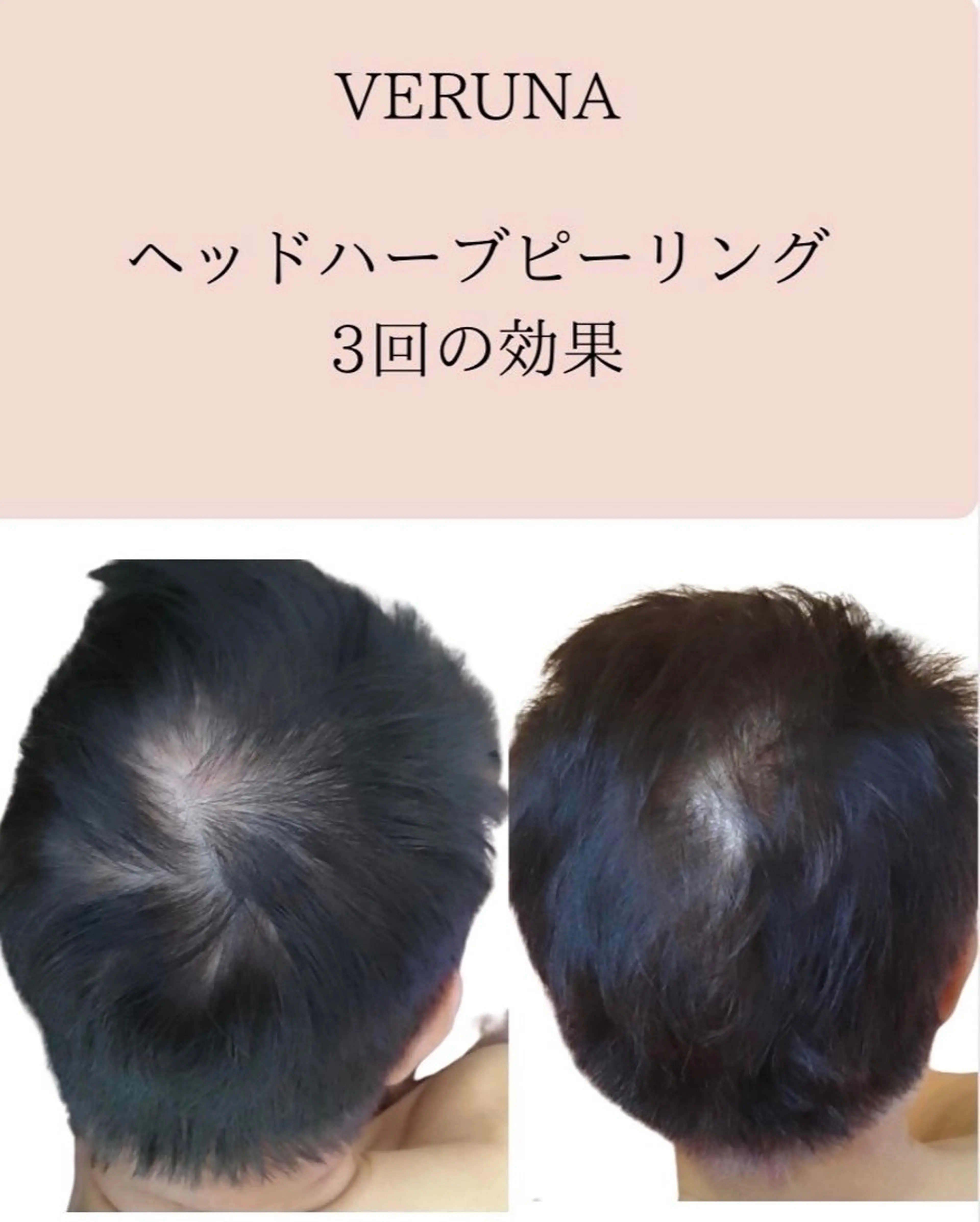 エステ リラク ニキビ改善専門店 d'Albaのエステ・リラクイメージ