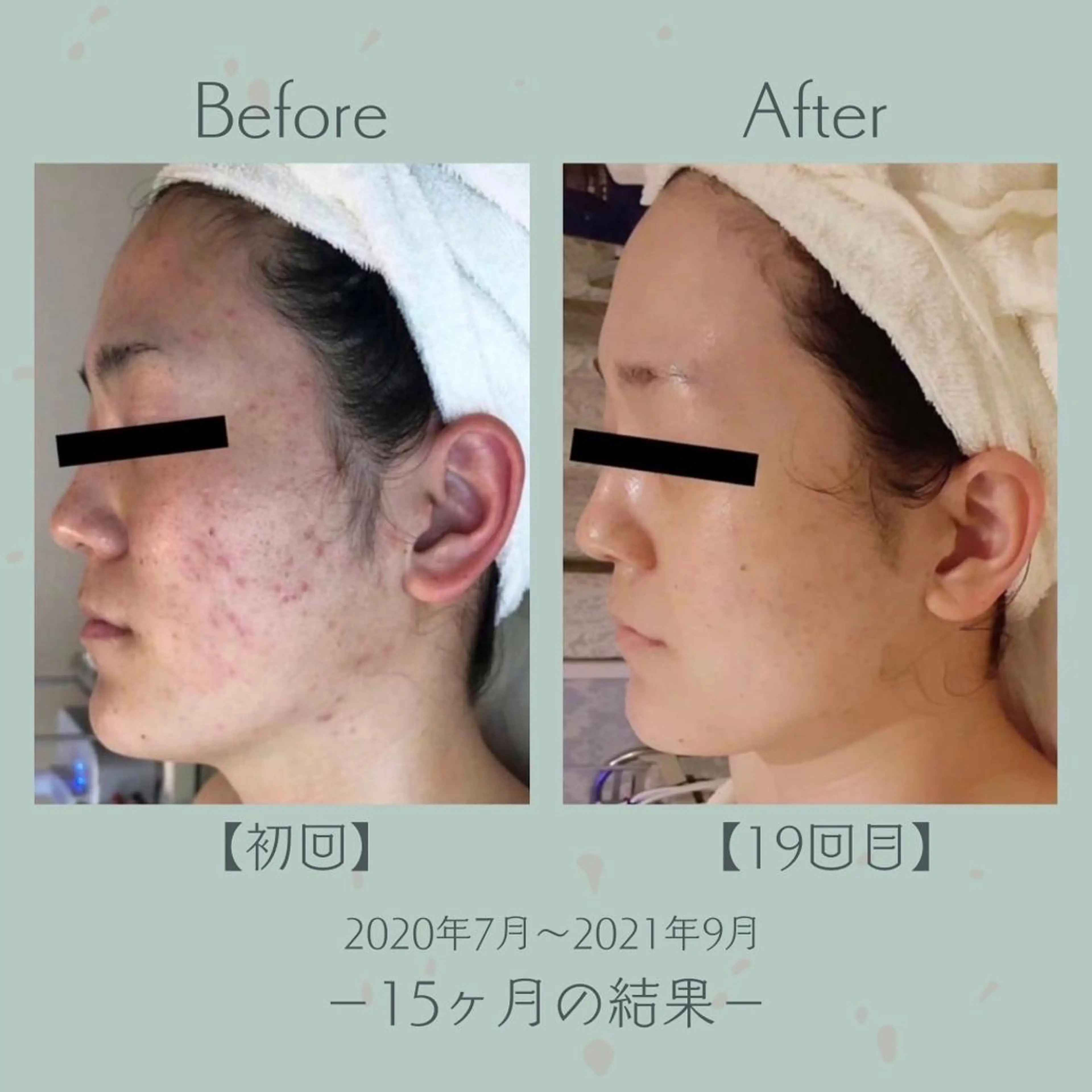 エステツイン広島店 FacialBodyのその他イメージ