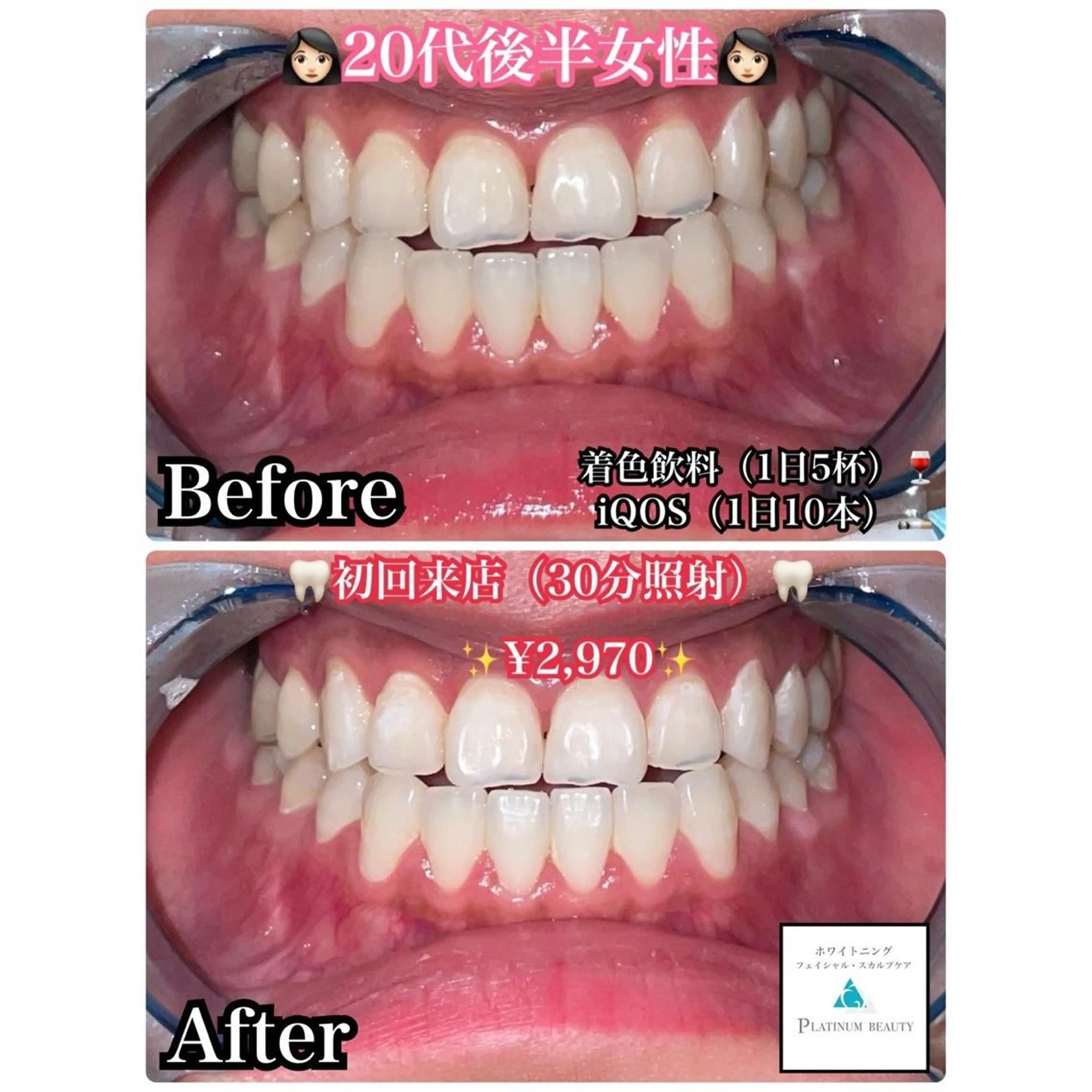 ホワイトニングビューティー西宮店所属・ホワイトニングビュー ティー西宮店のその他イメージ