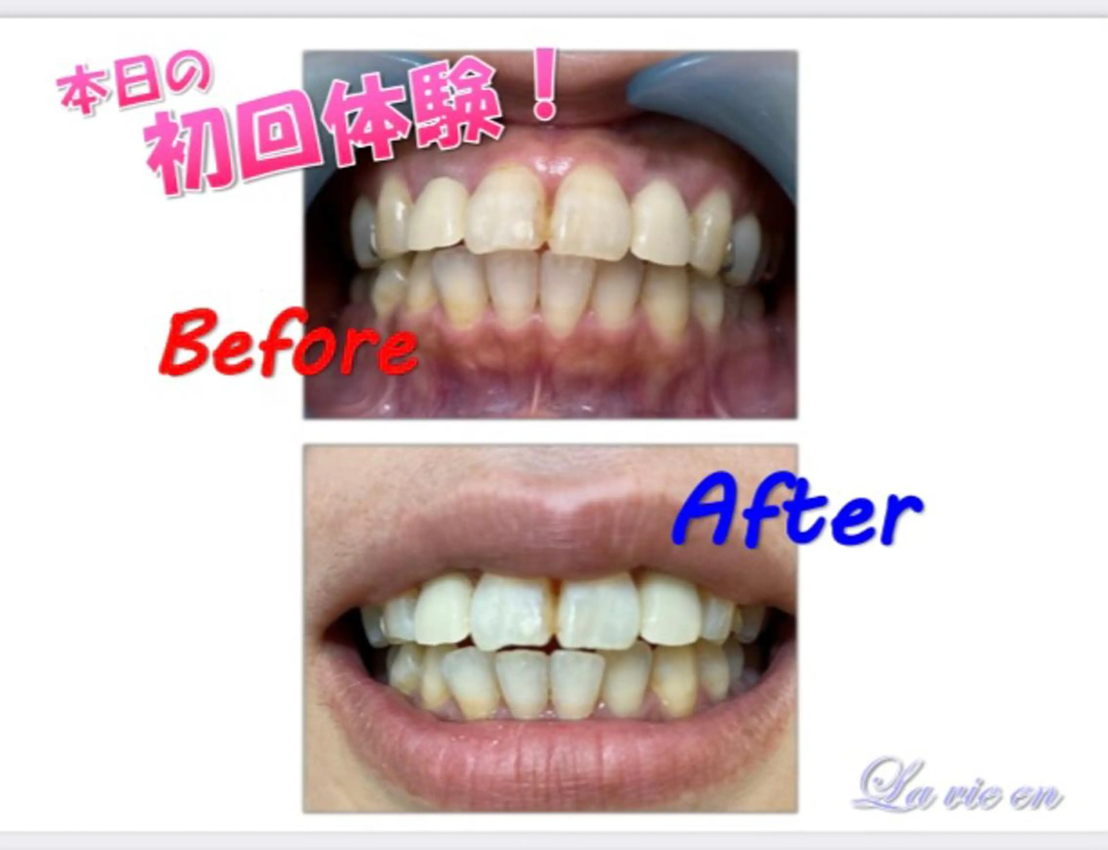 その他 セルフホワイトニングサロン　ラヴィアン所属・ホワイトニングサロン La vie enのその他イメージ