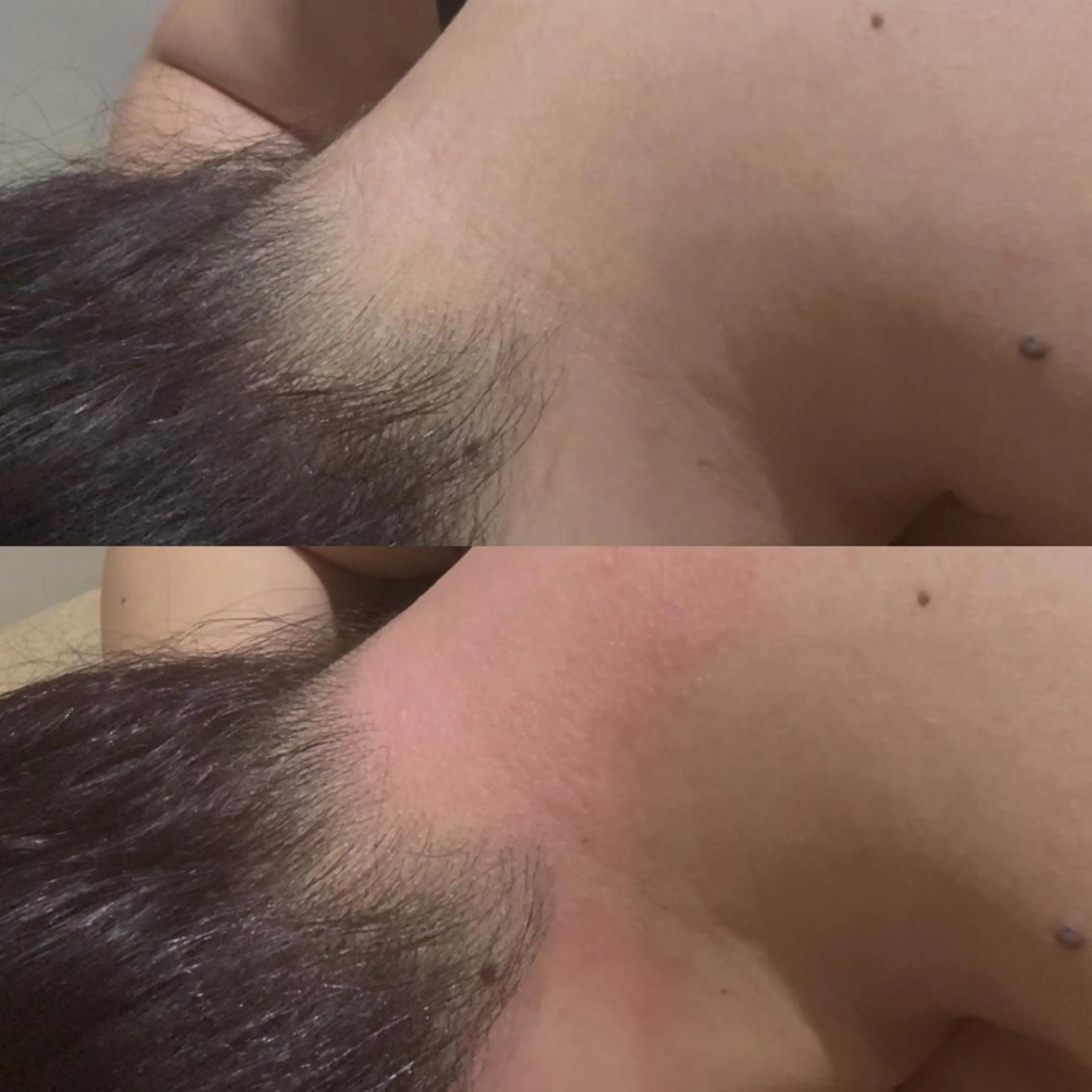 脱毛 August 山本のマツエク・マツパデザイン