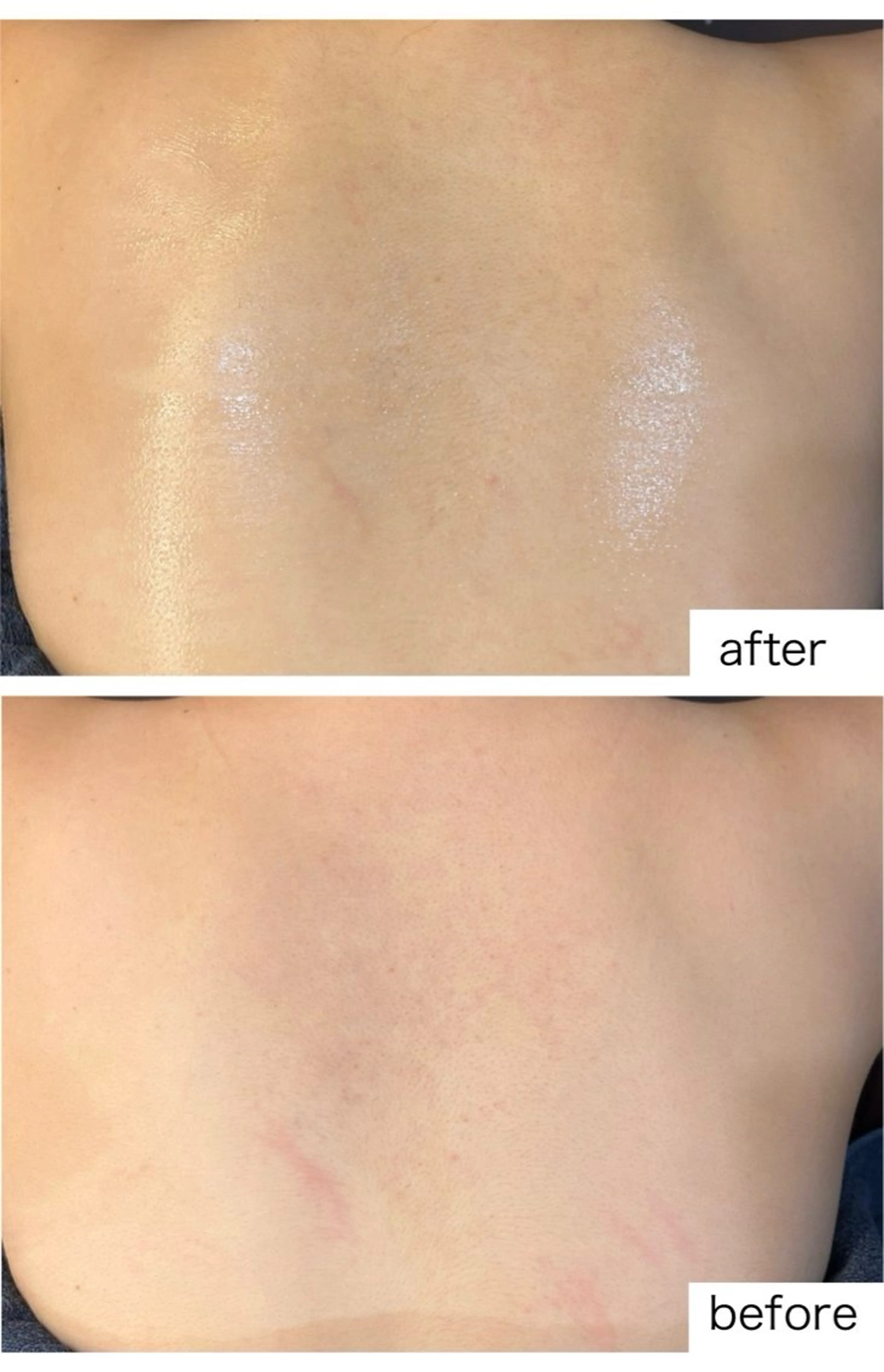 leolo武蔵浦和 肌質改善&脱毛のエステ・リラクイメージ