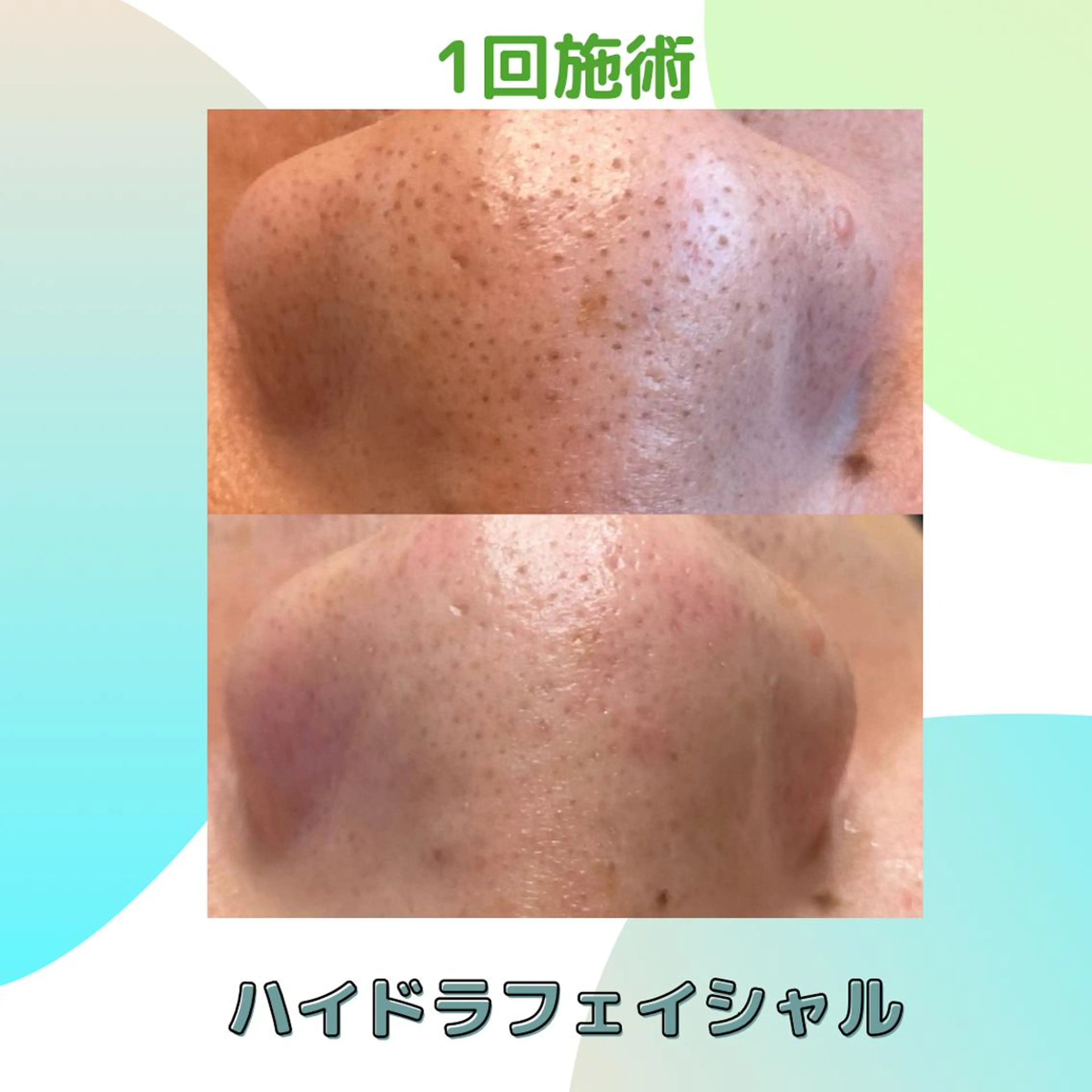 エステ Emu beautysalon所属・Emu beauty salonのエステ・リラクイメージ