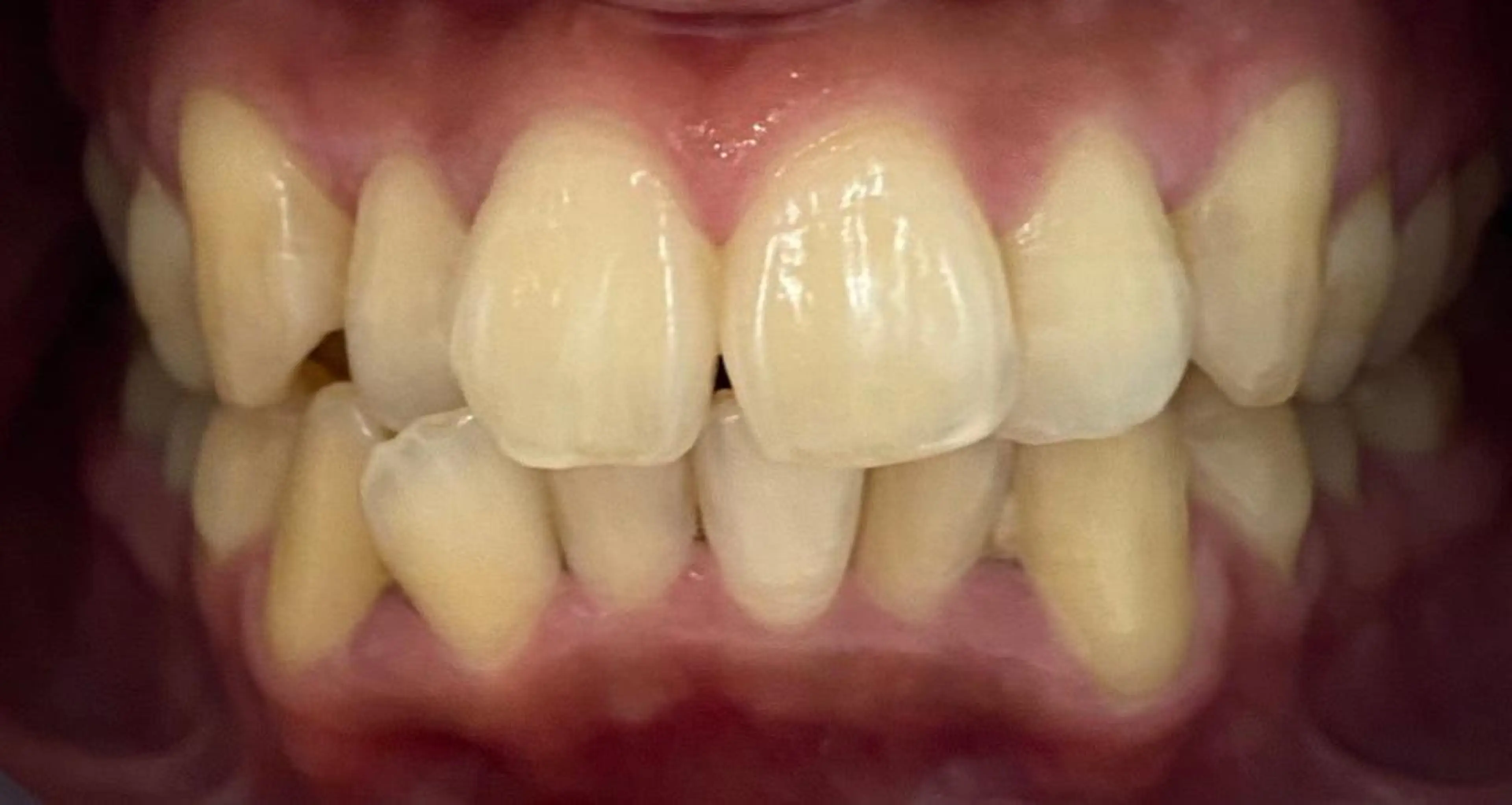 セルフホワイトニングサロン　ラヴィアン所属・ホワイトニングサロン La vie enのその他イメージ