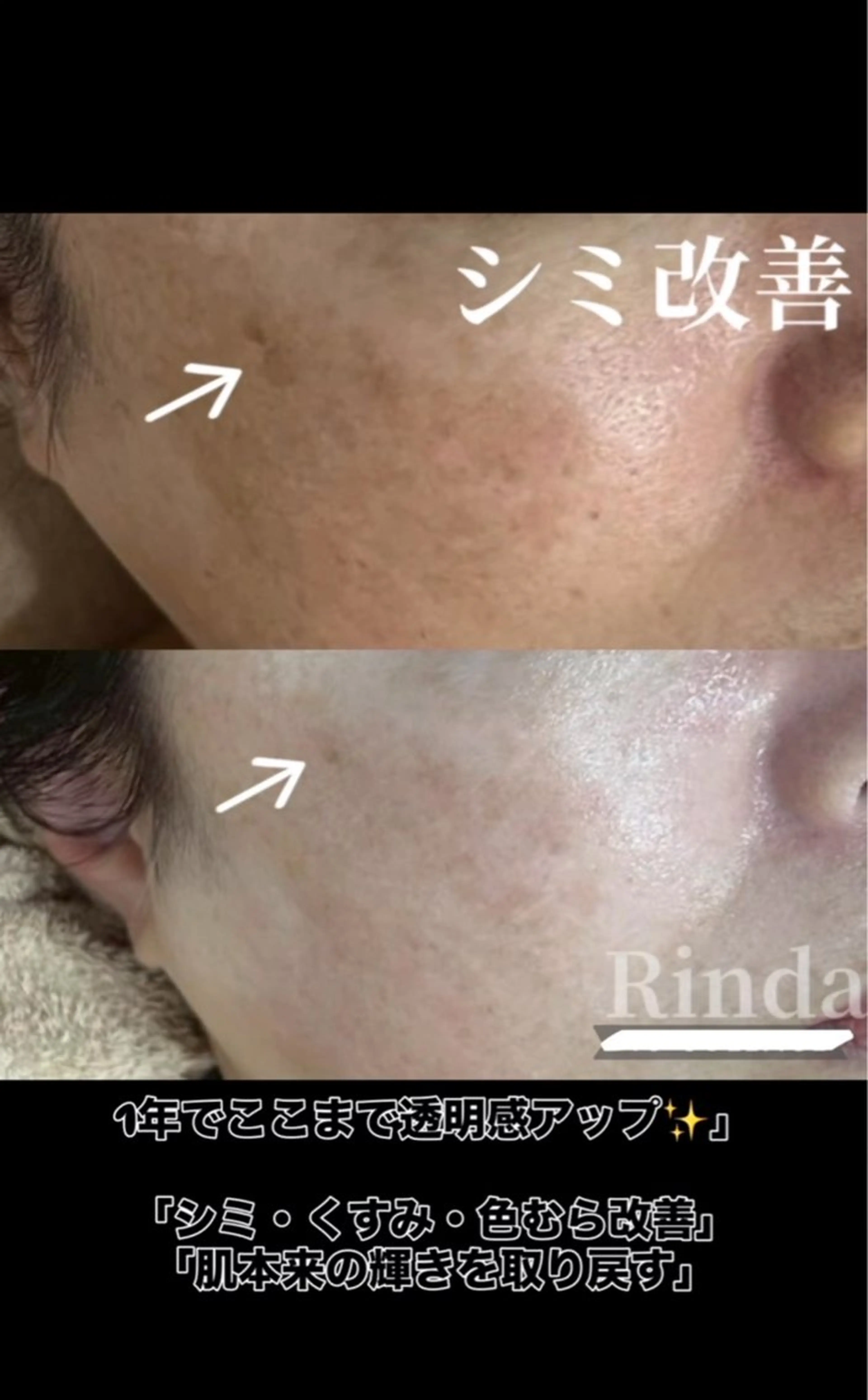 エステ ブライダル痩身×脱毛 尼崎駅前サロンのエステ・リラクイメージ