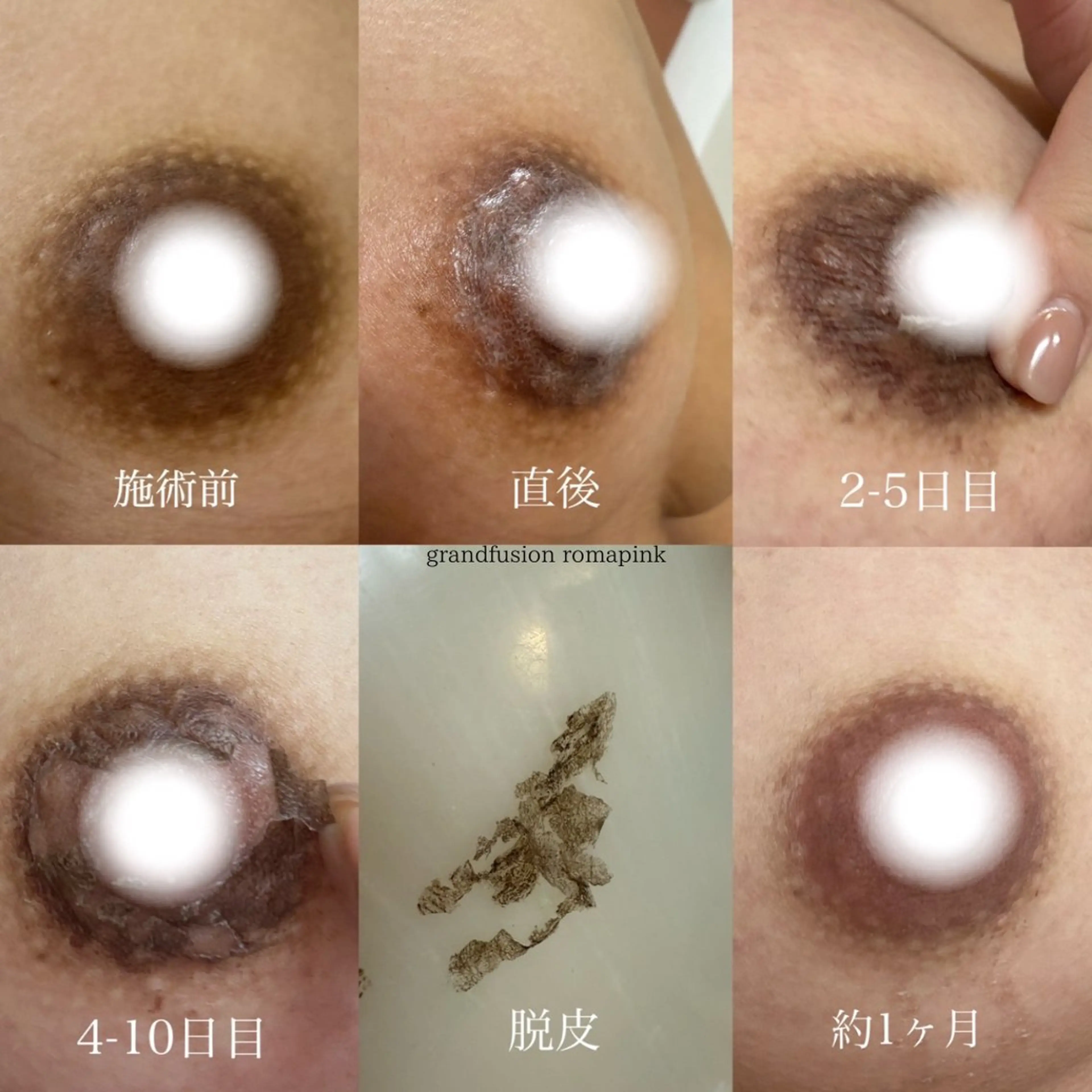 強力痩身専門サロン /ローマピンク導入店のその他イメージ