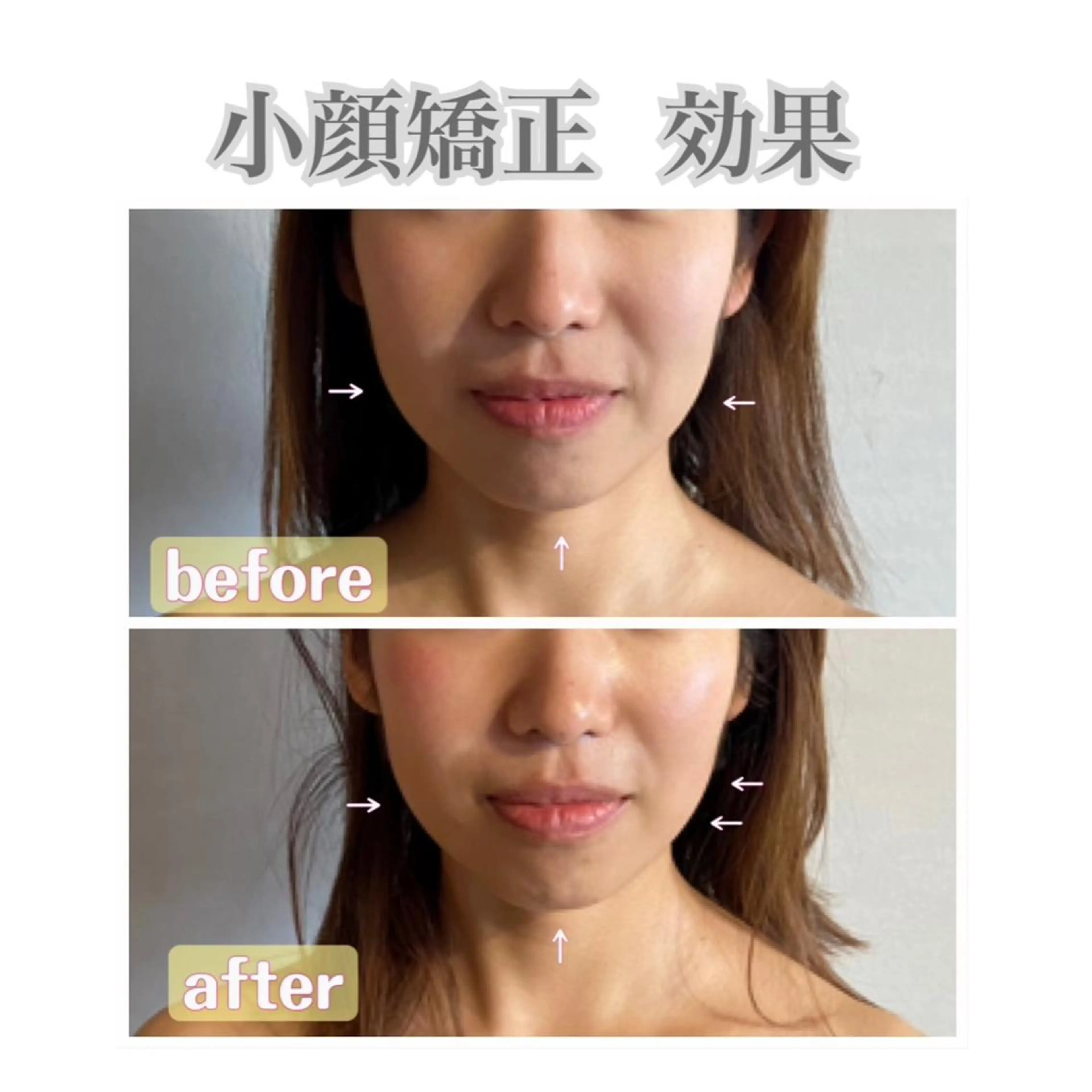 salon ace所属・【小顔矯正】 salonaceのエステ・リラクイメージ