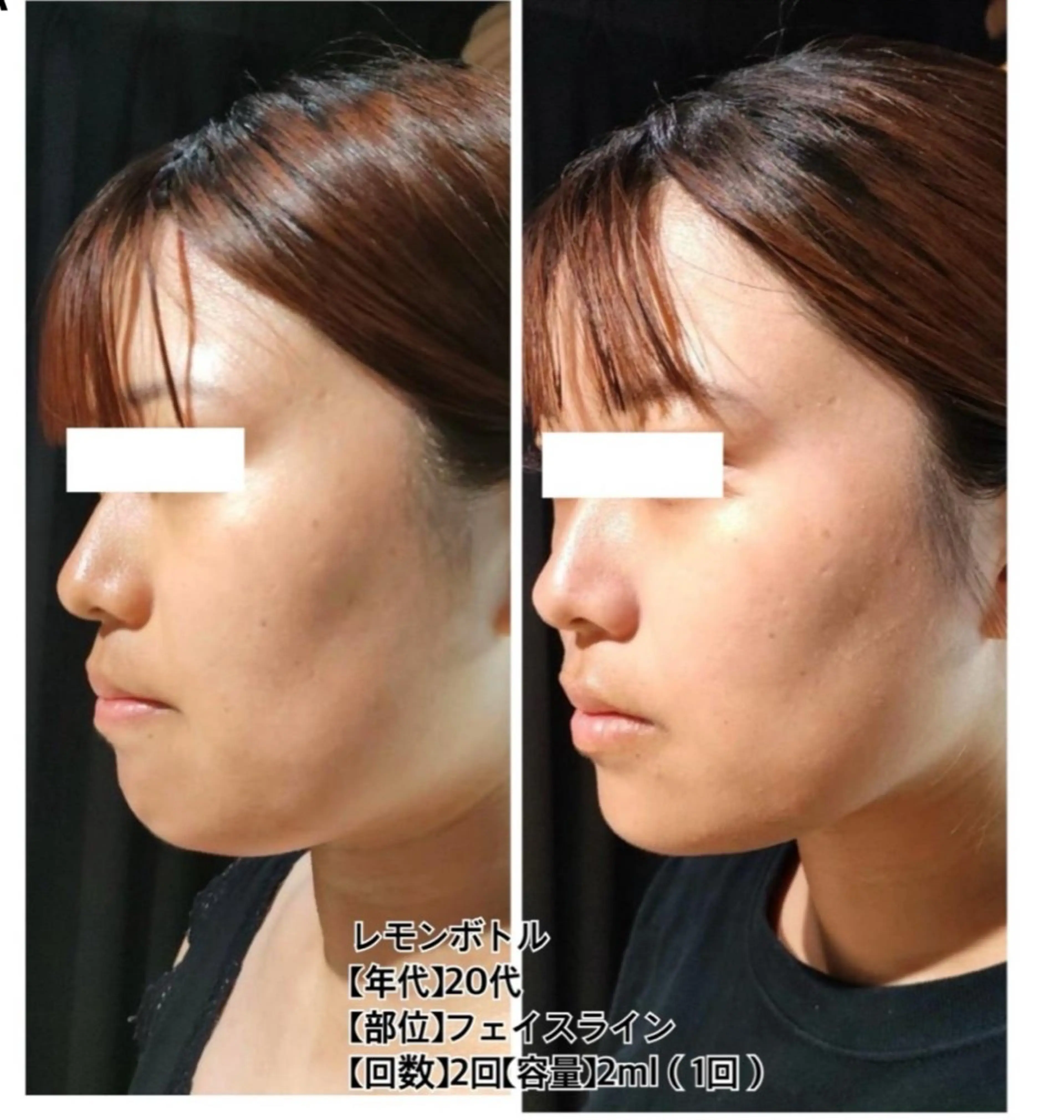 ベルーテ エッセンスのエステ・リラクイメージ