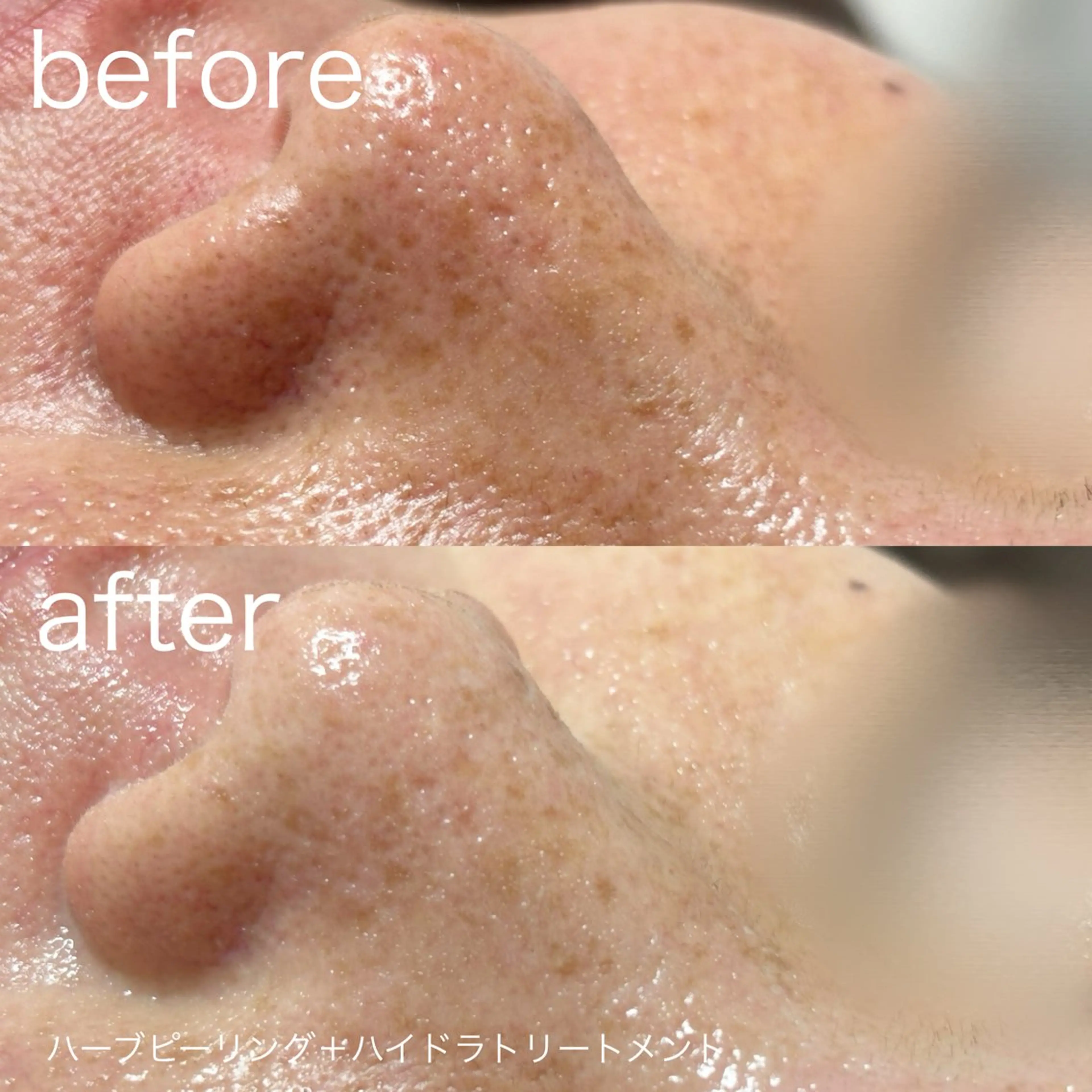 その他 lulularico Yuのエステ・リラクイメージ