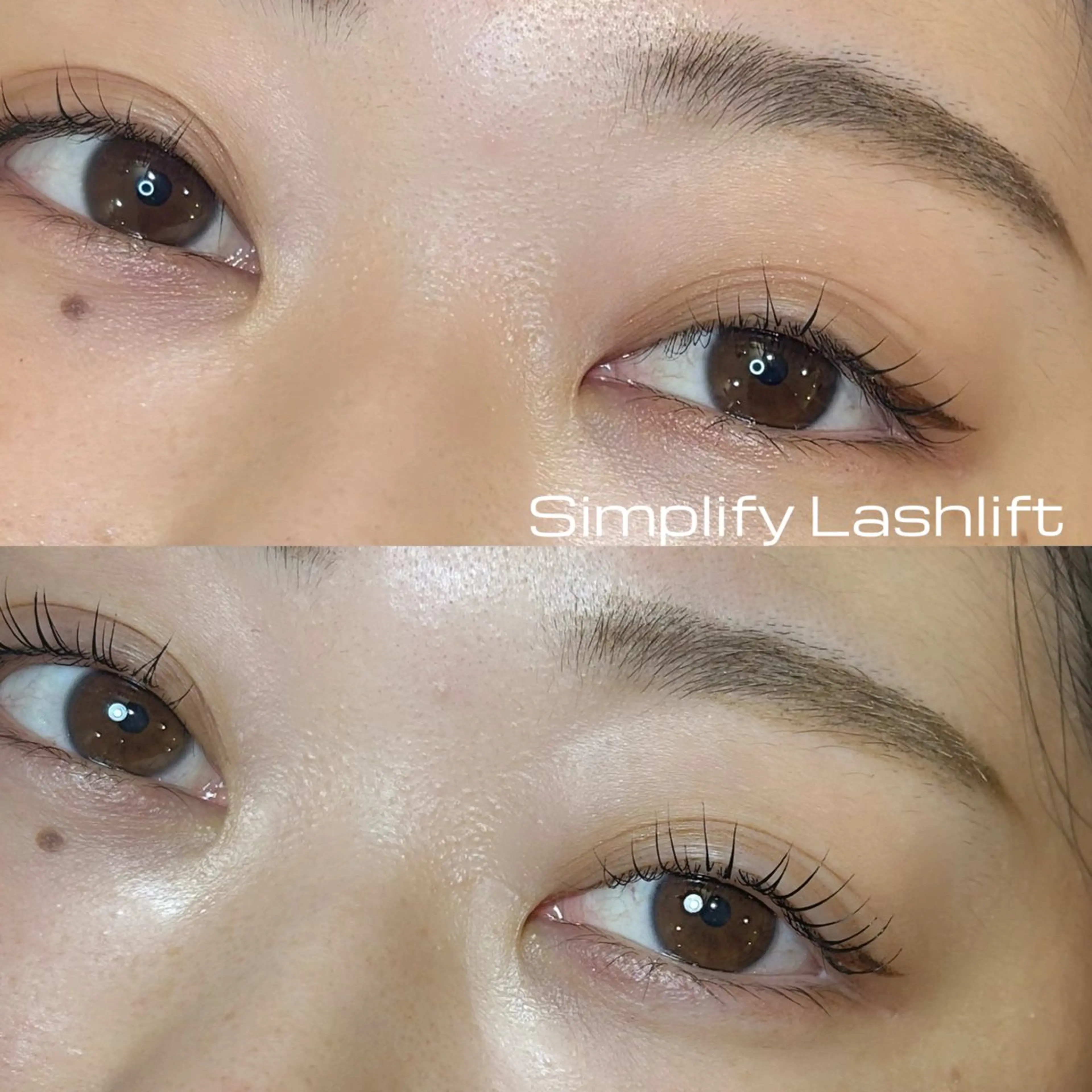 モニター価格【シンプリフィラッシュリフト】の写真