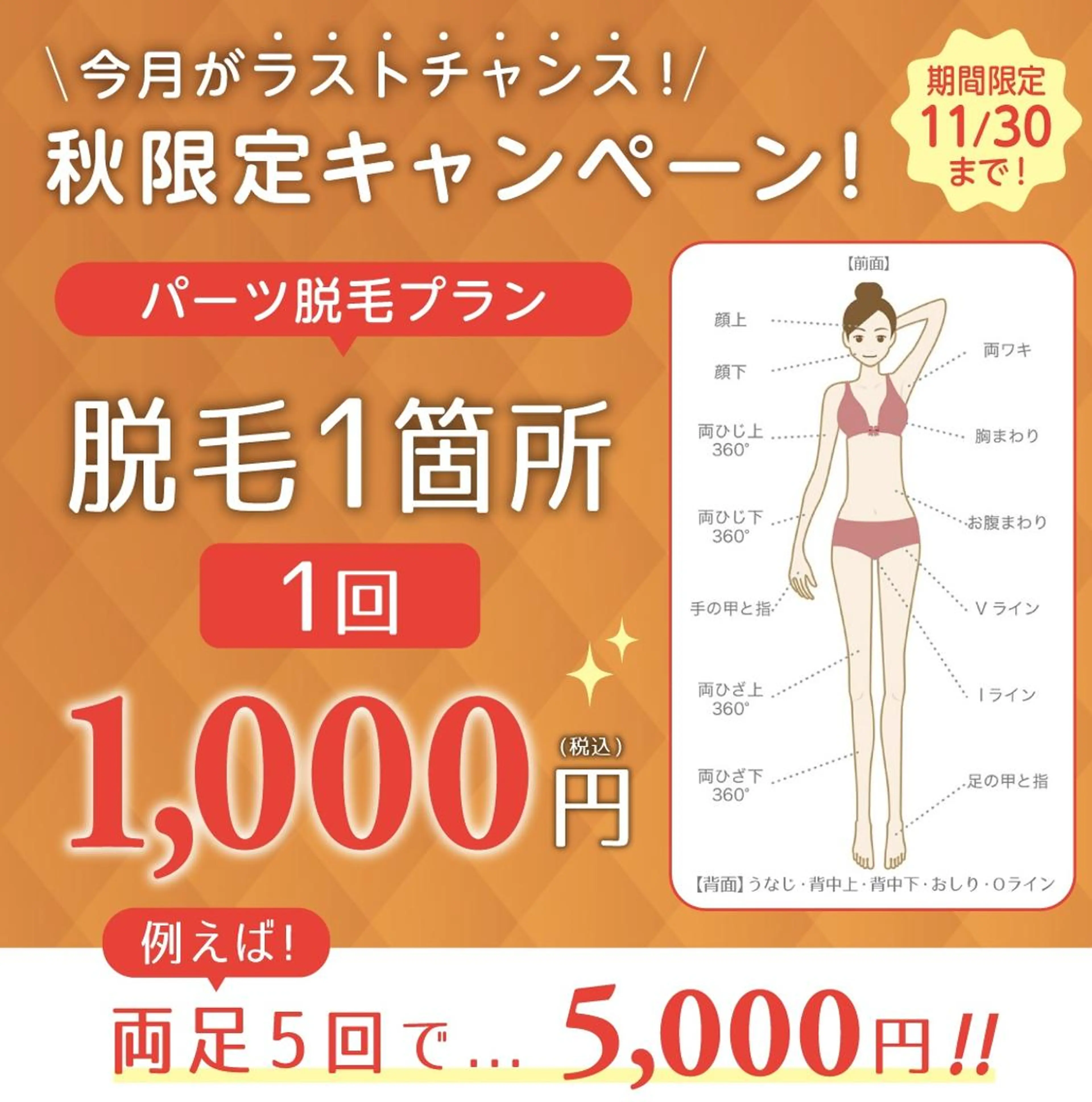 【11月限定】パーツ脱毛プラン1回1,000円の写真