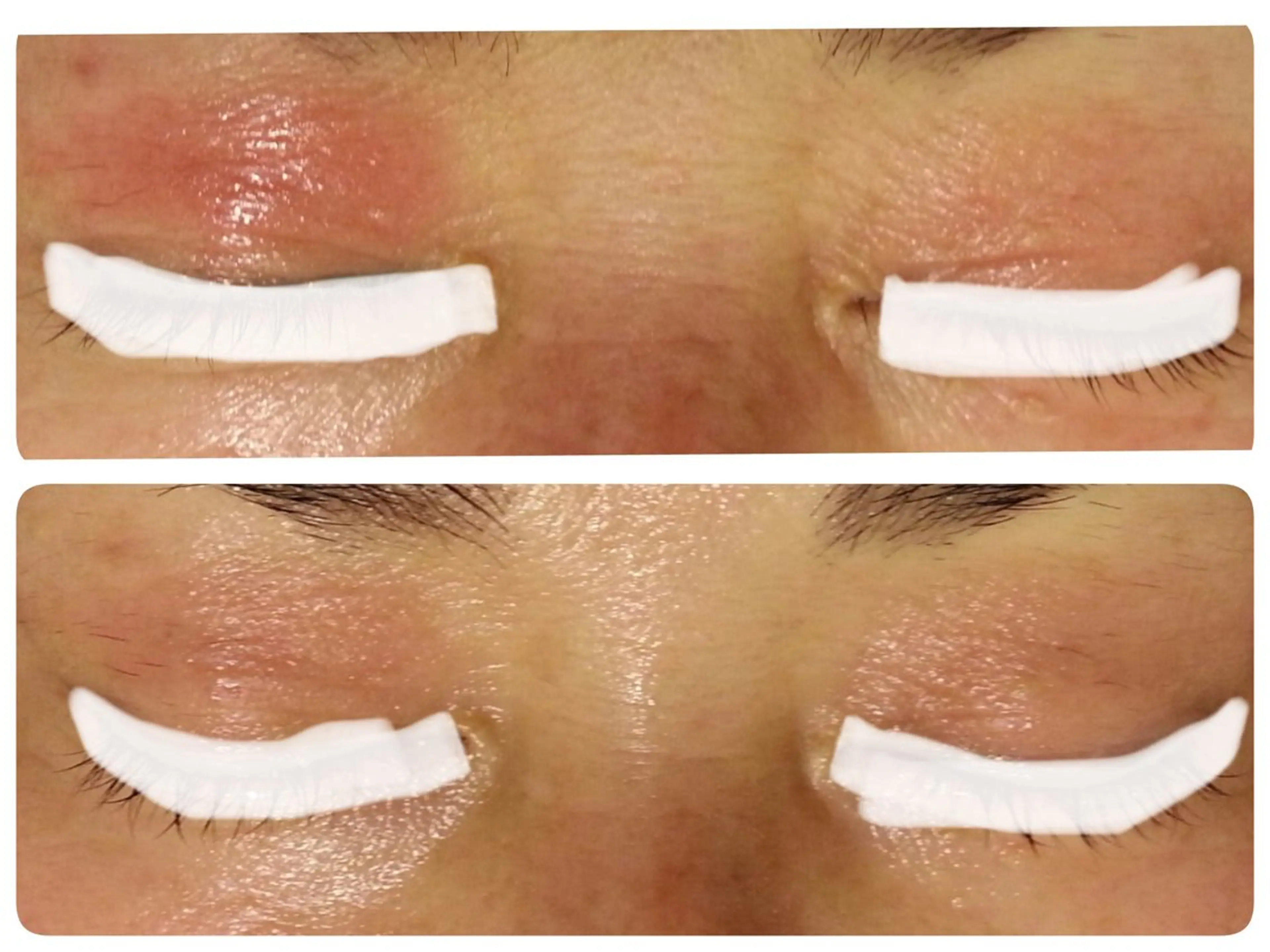 ピーリングサロン シャンテール所属・ピーリングサロン シャンテールのエステ・リラクイメージ