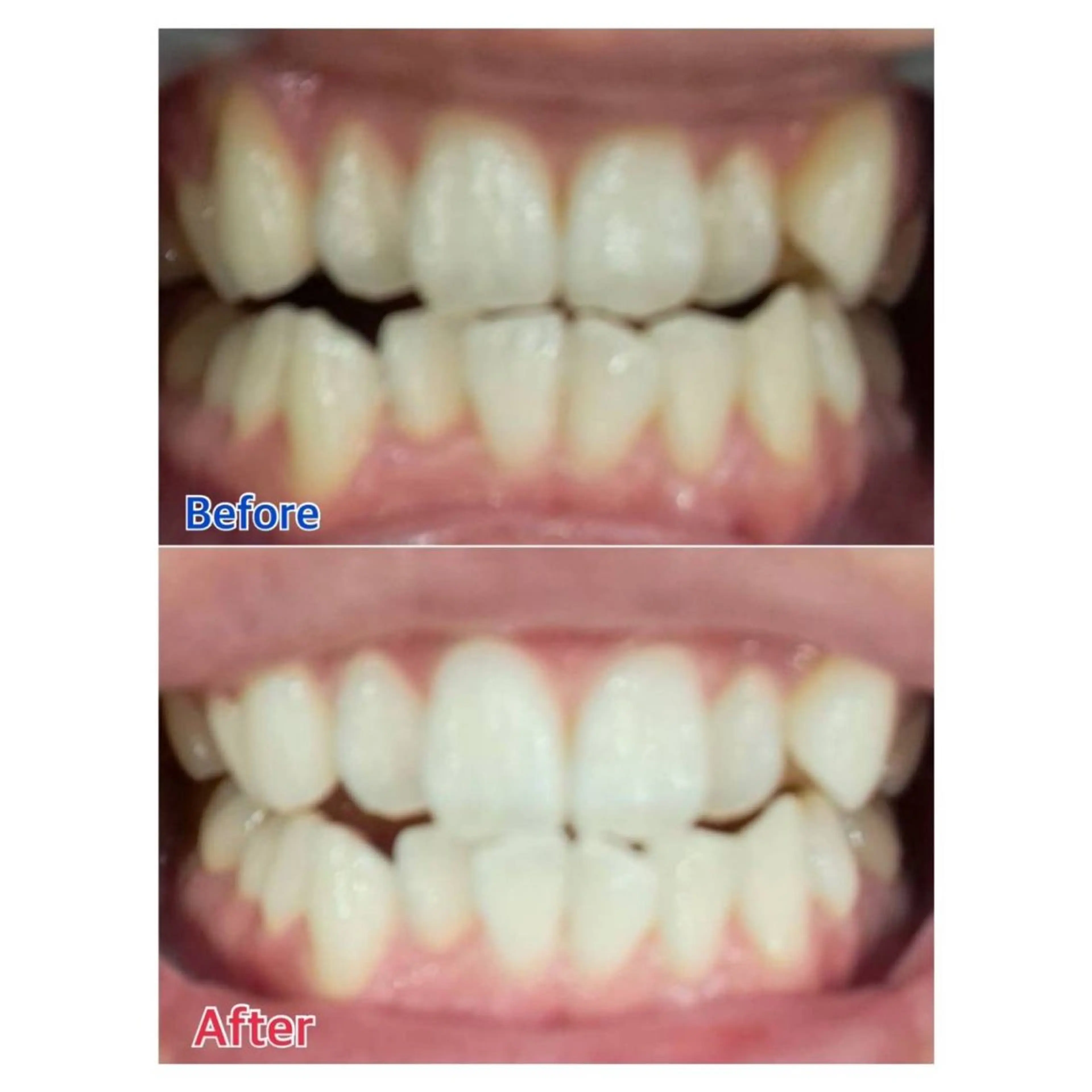 MBEAUTYSALON 千葉店・京成大久保所属・Melty 輝のその他イメージ