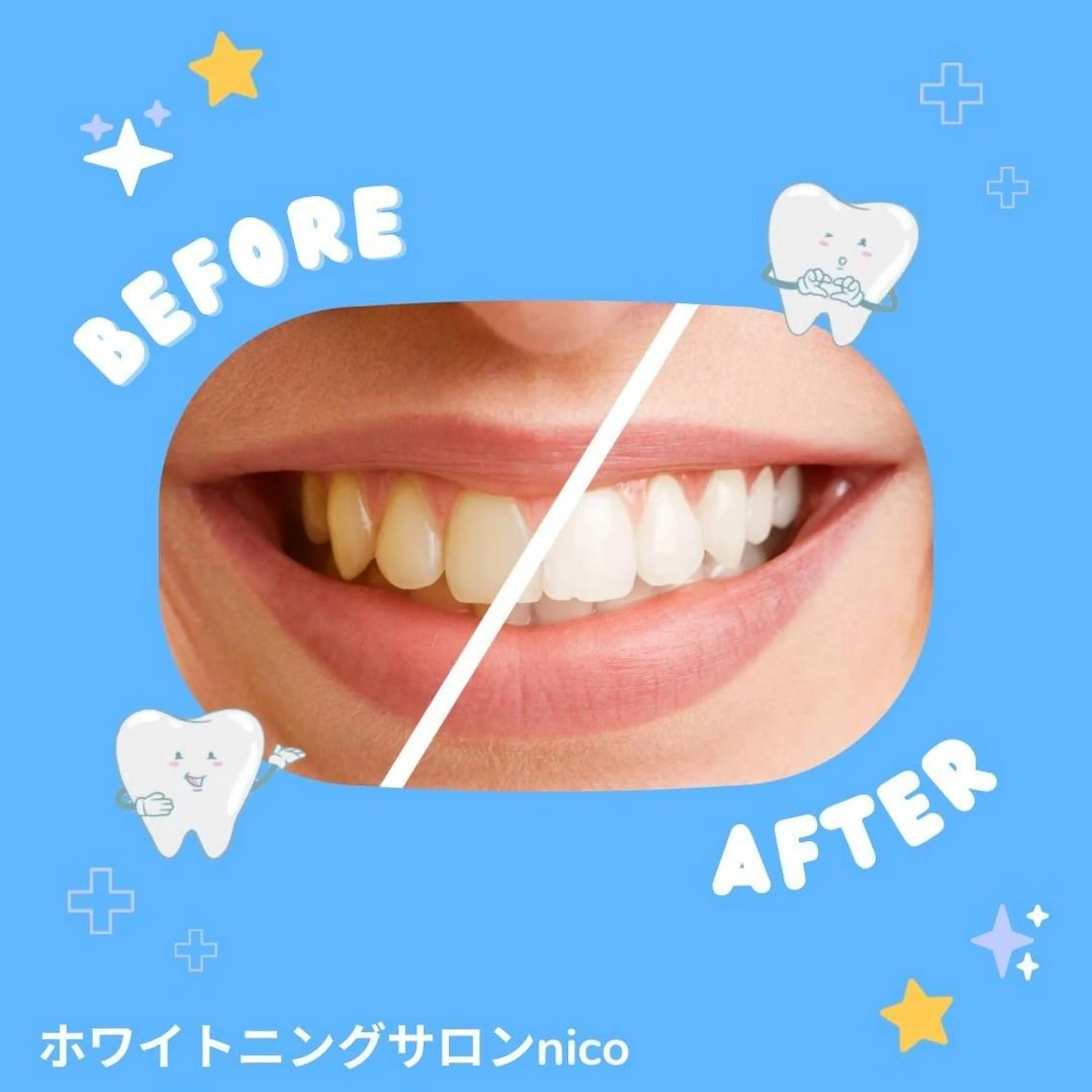 ロング パーマ その他 ホワイトニングサロン nico西葛西店のその他イメージ
