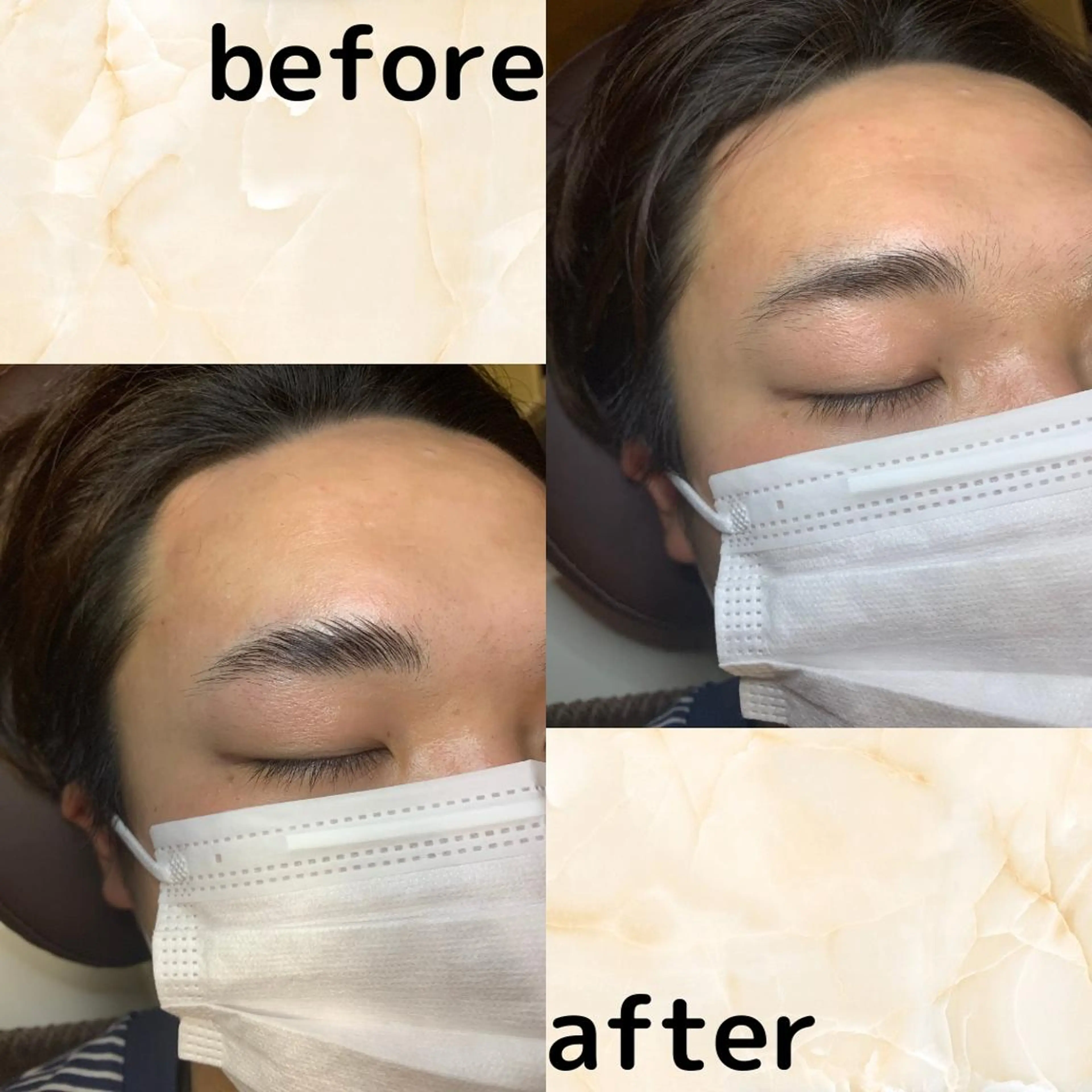 メンズ 20代から始める脱毛 salonLEPIAのエステ・リラクイメージ