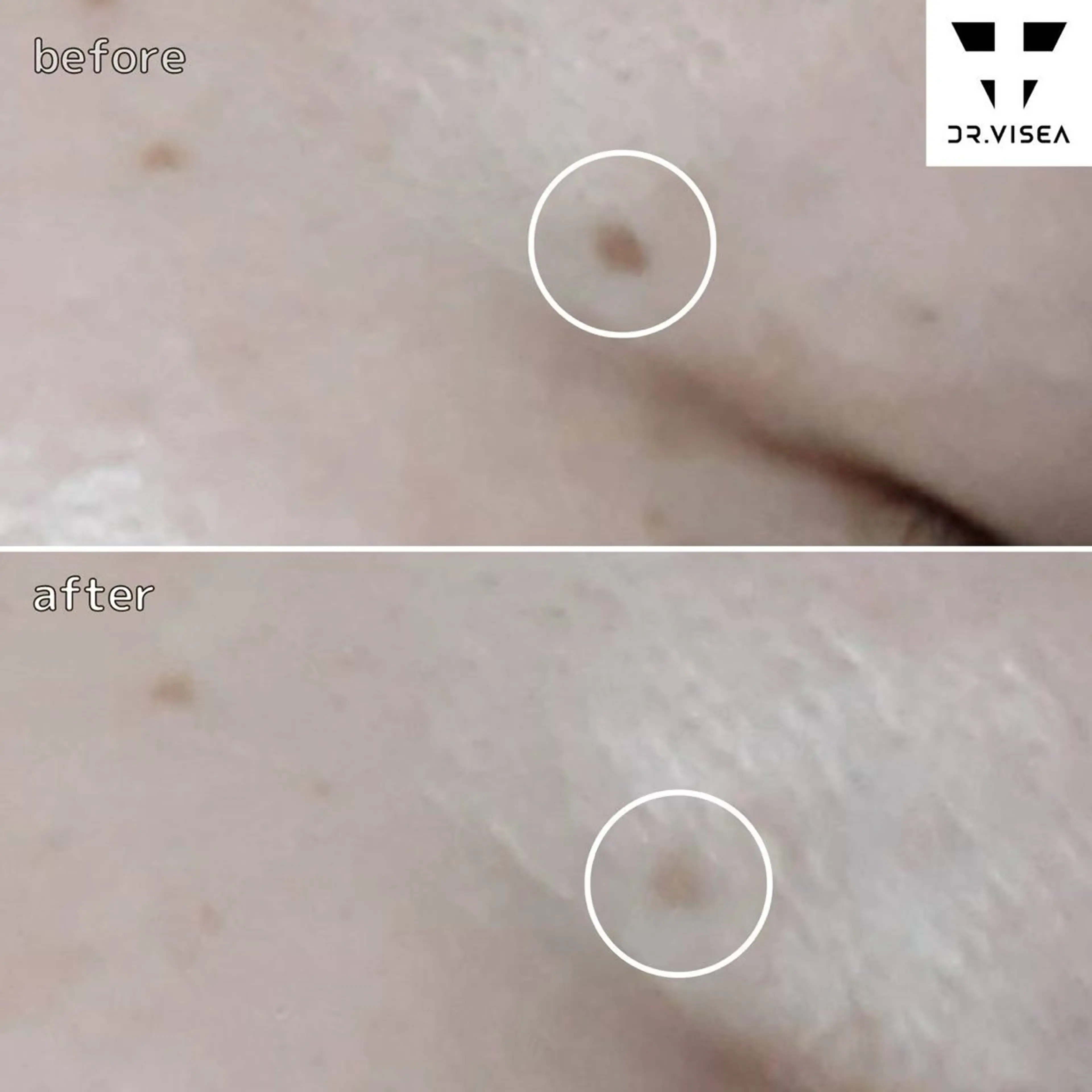 エステ EMILY守山店所属・EMILY 守山店のマツエク・マツパデザイン