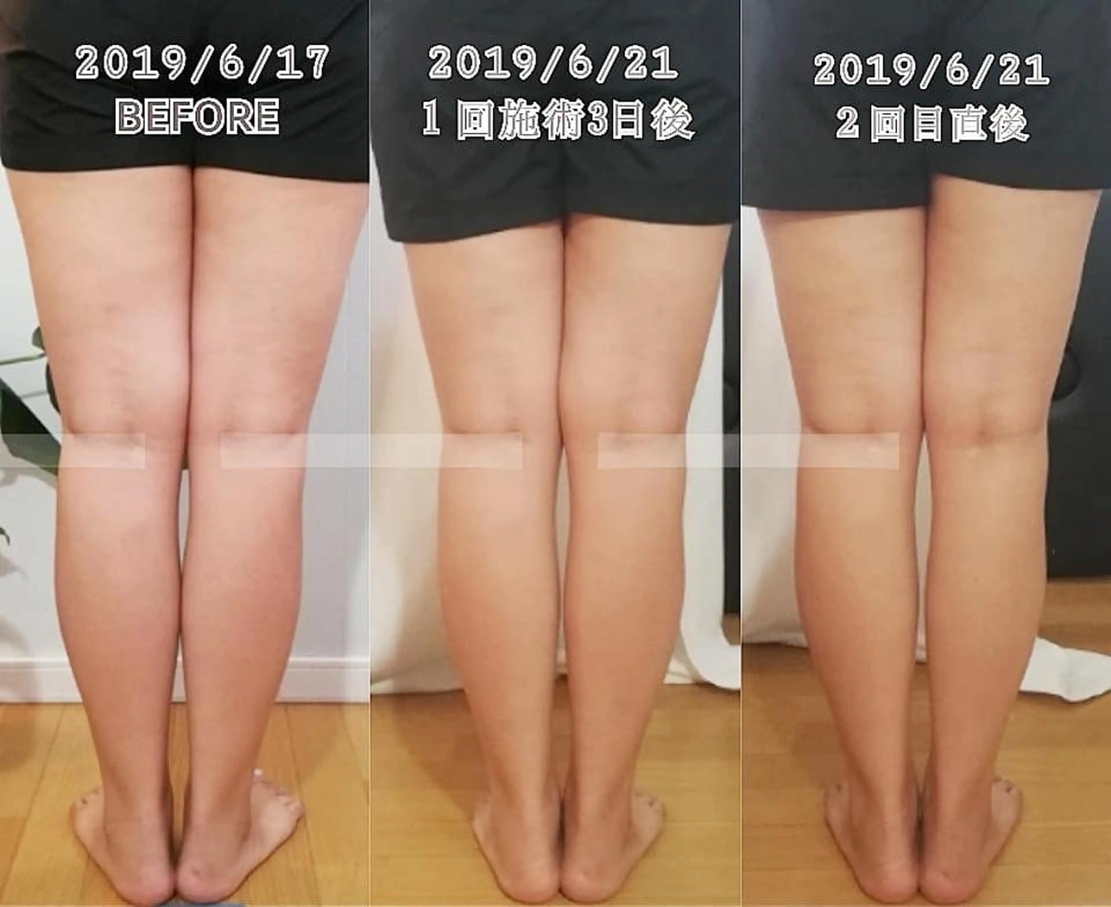 LATTE マツエク&ハイパーナイフ所属・LATTE eyelashのマツエク・マツパデザイン