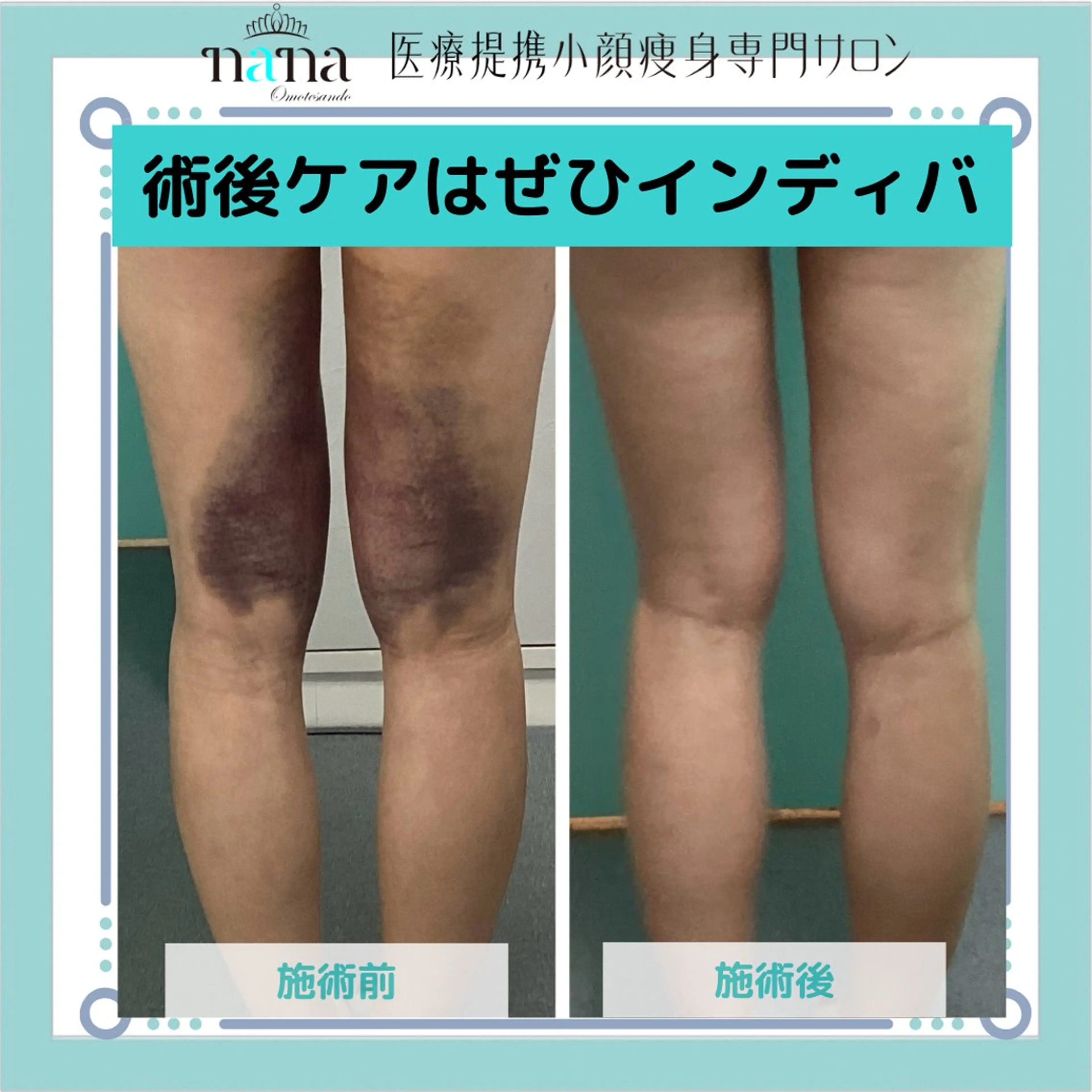 エステ リラク 小顔痩身インディバ Nana表参道のエステ・リラクイメージ