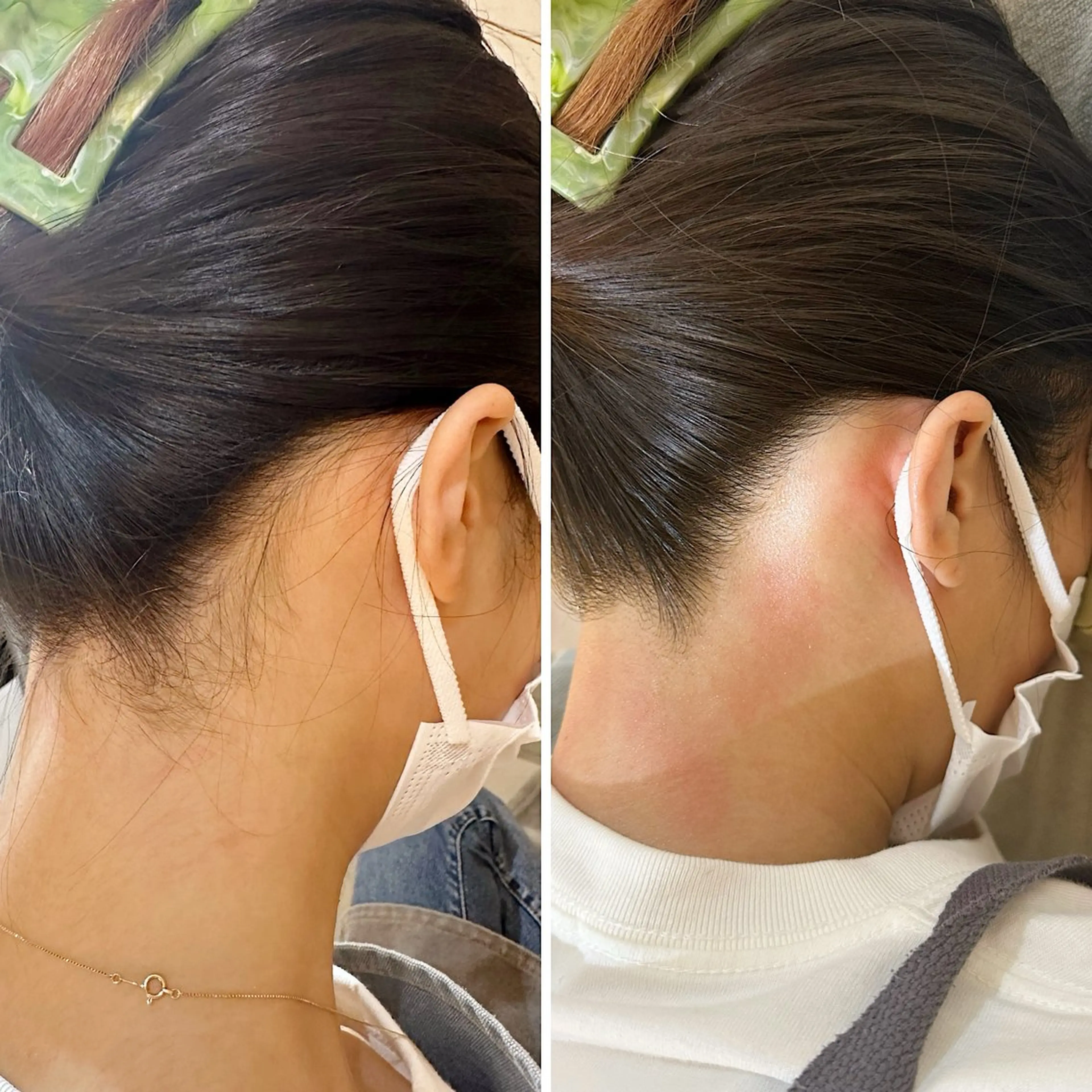 脱毛 うなじ脱毛/美肌脱毛 LABELのエステ・リラクイメージ