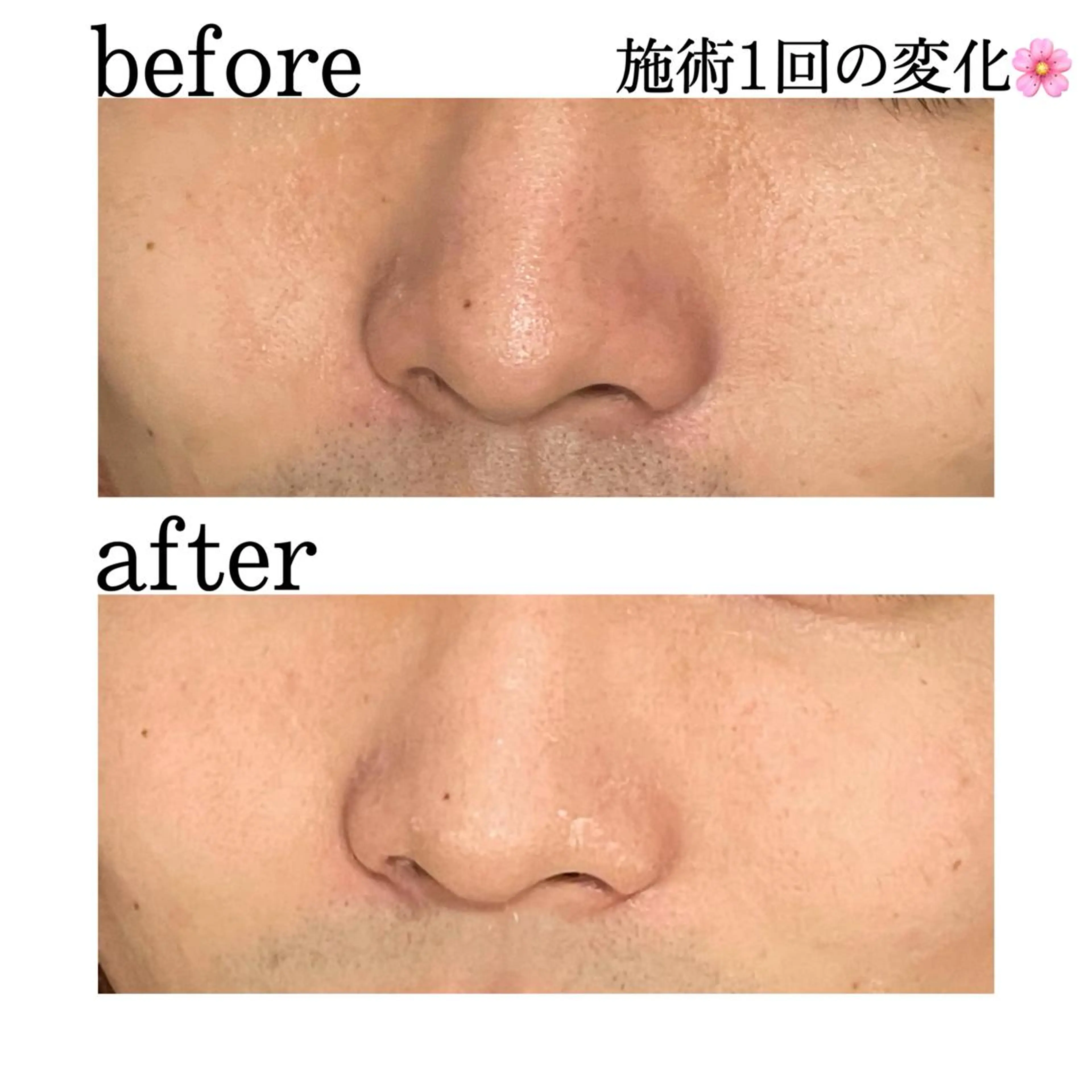 触れたくなる モテ肌へ...❤︎のエステ・リラクイメージ