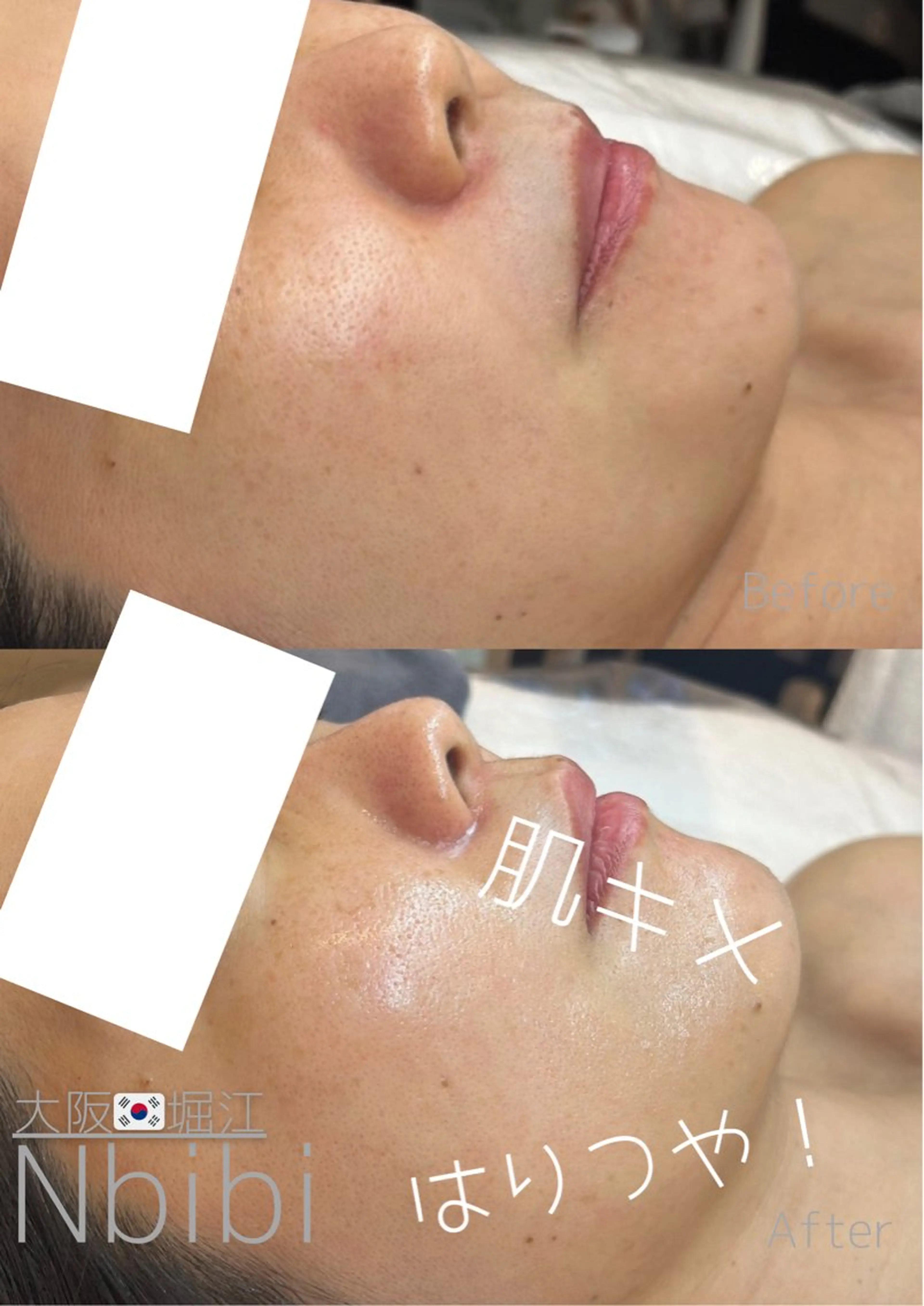 エステ 韓国🇰🇷価格 サロン_Nbibiのエステ・リラクイメージ