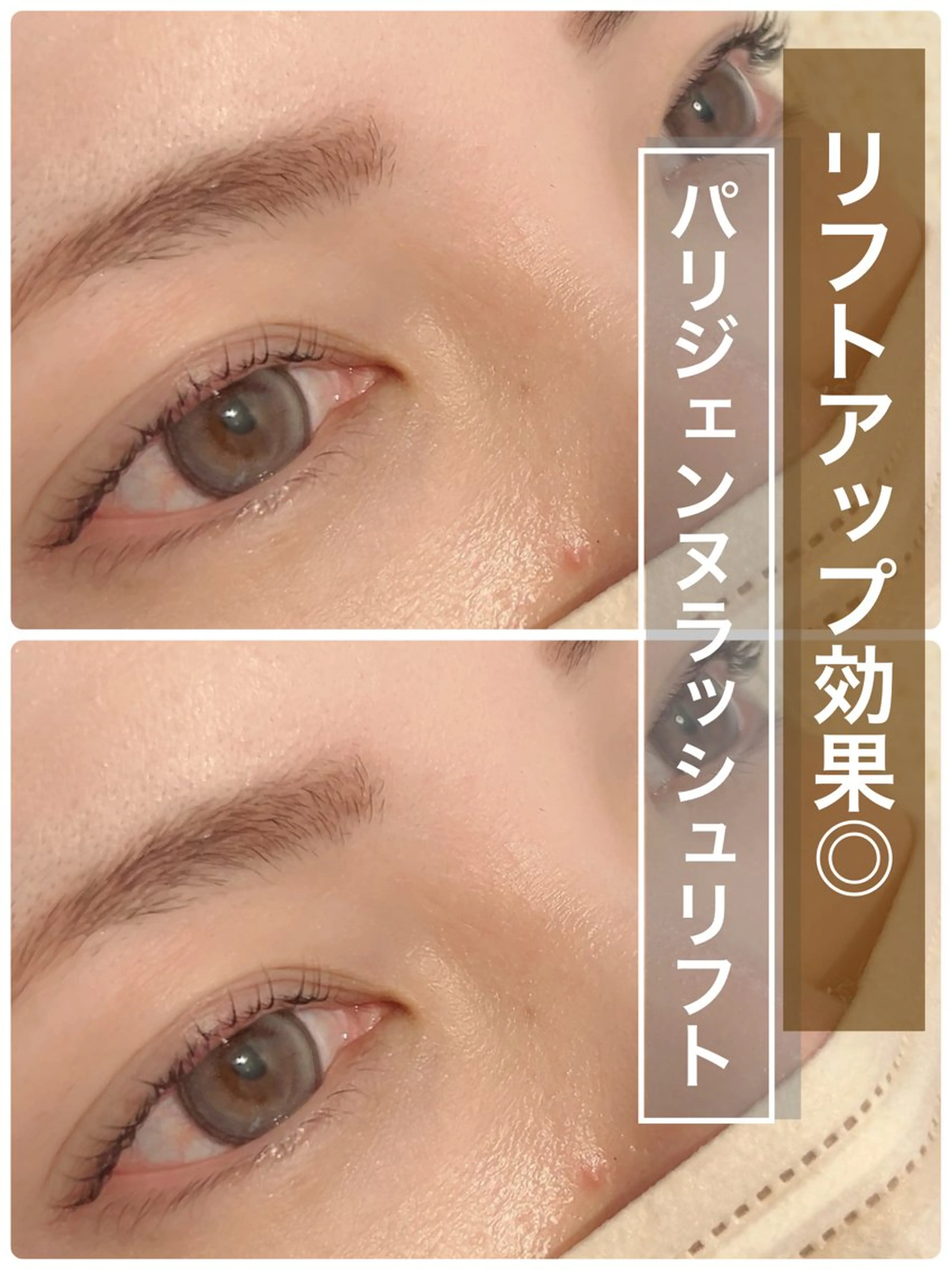 マツエク・マツパ FERNA フェルナのその他イメージ