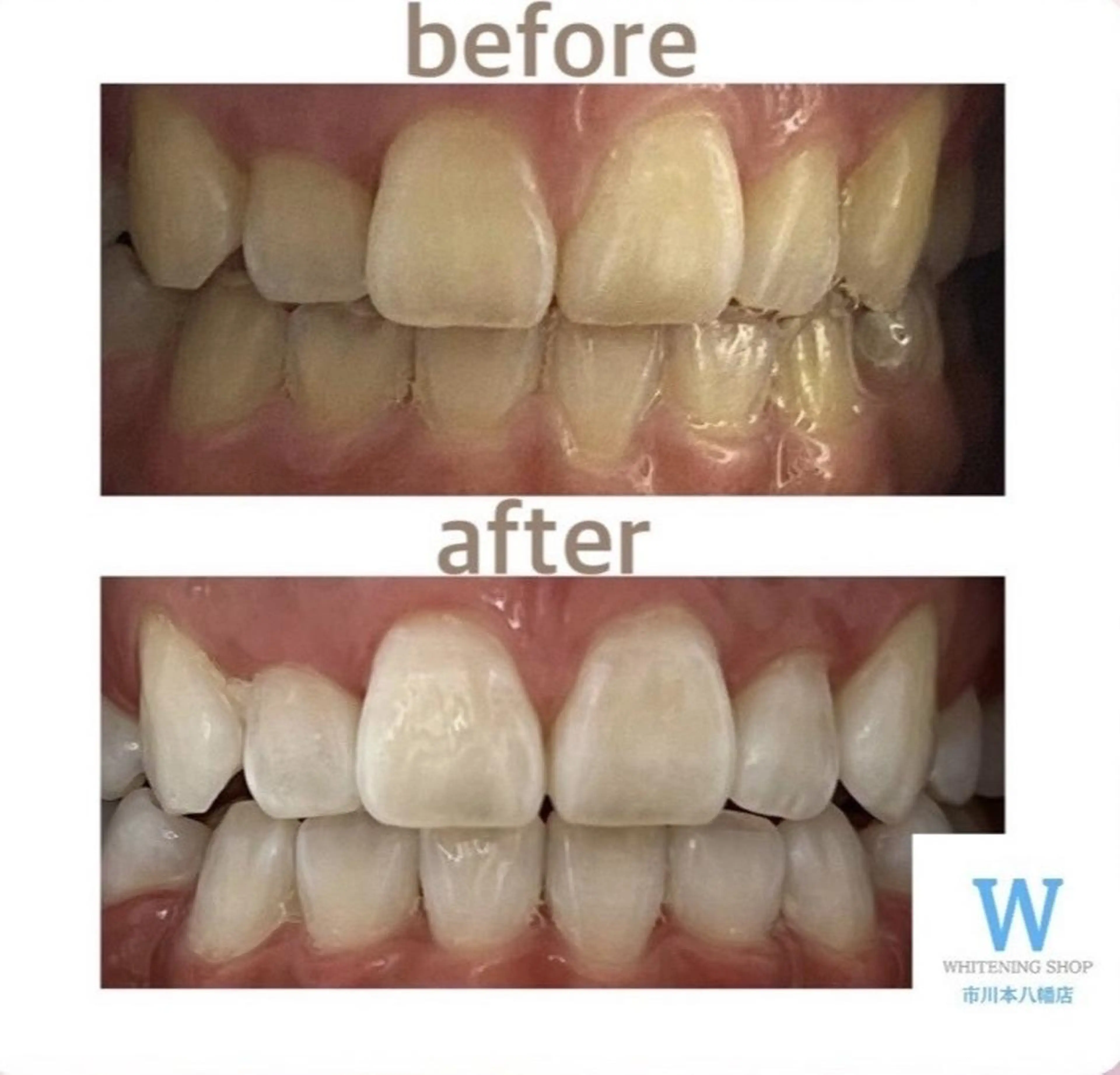 ホワイトニング ショップ本八幡店のエステ・リラクイメージ