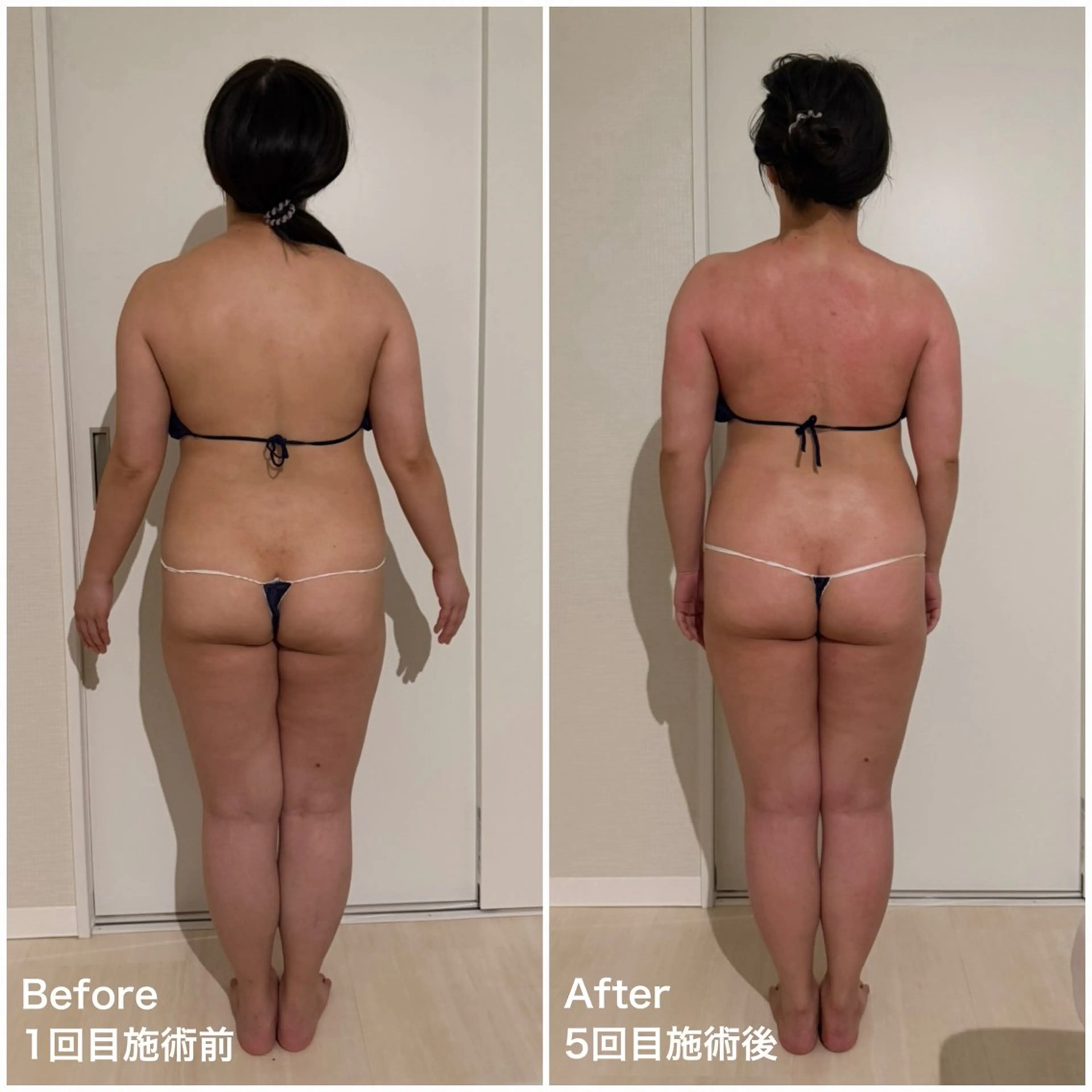 LibCharm🩰 村山美咲のエステ・リラクイメージ