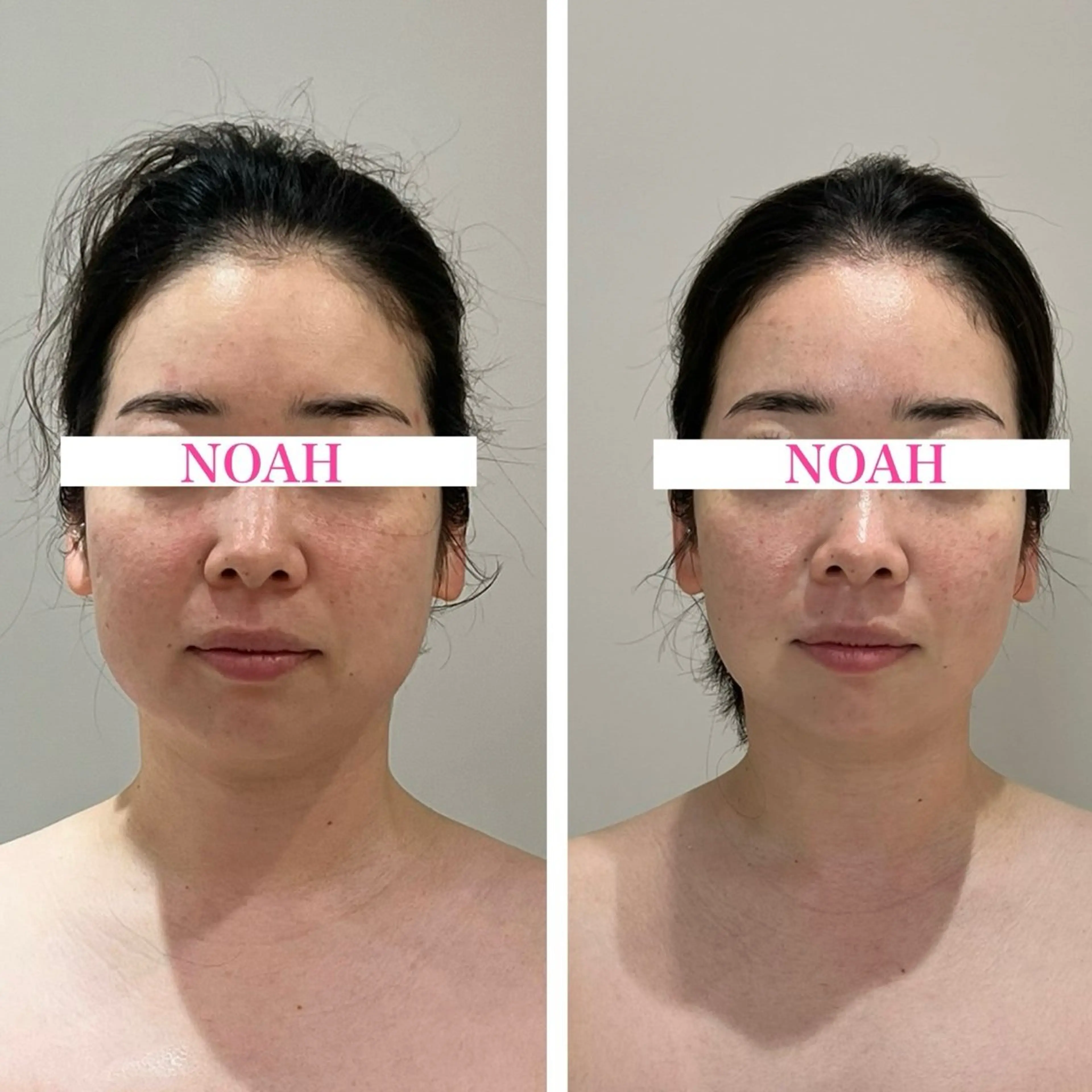 NOAH 小顔毛穴 川越店所属・NOAH ORIEのエステ・リラクイメージ