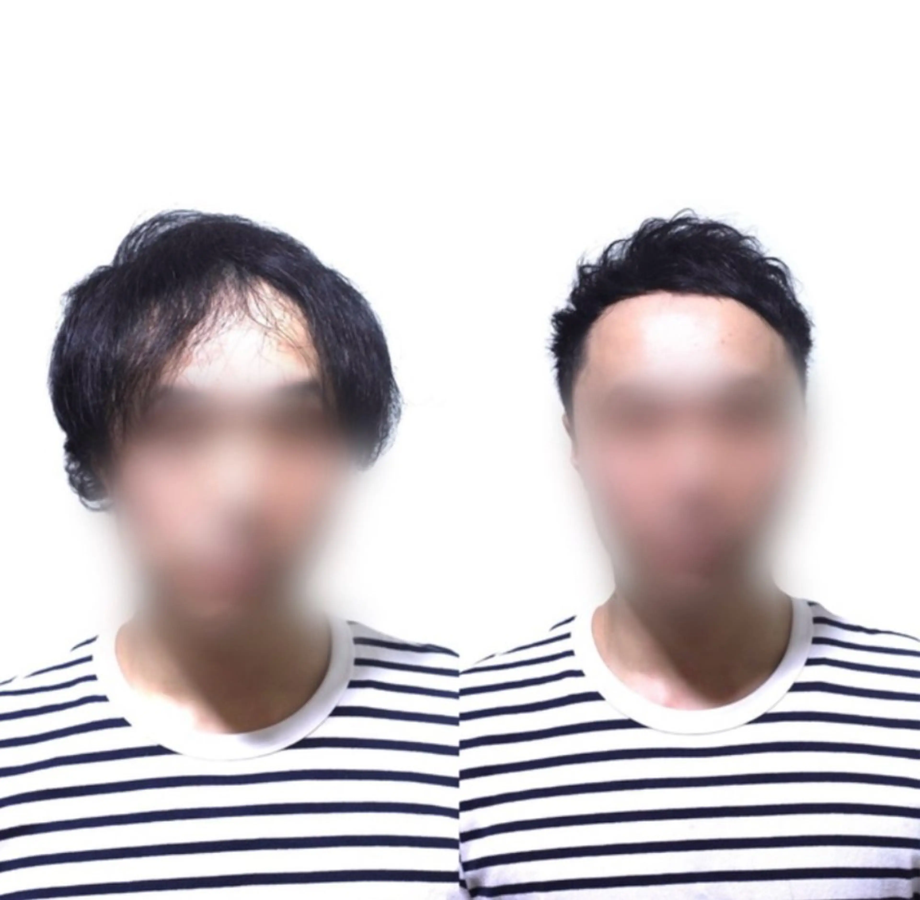 メンズ 薄毛専門美容師 和久井博のその他イメージ