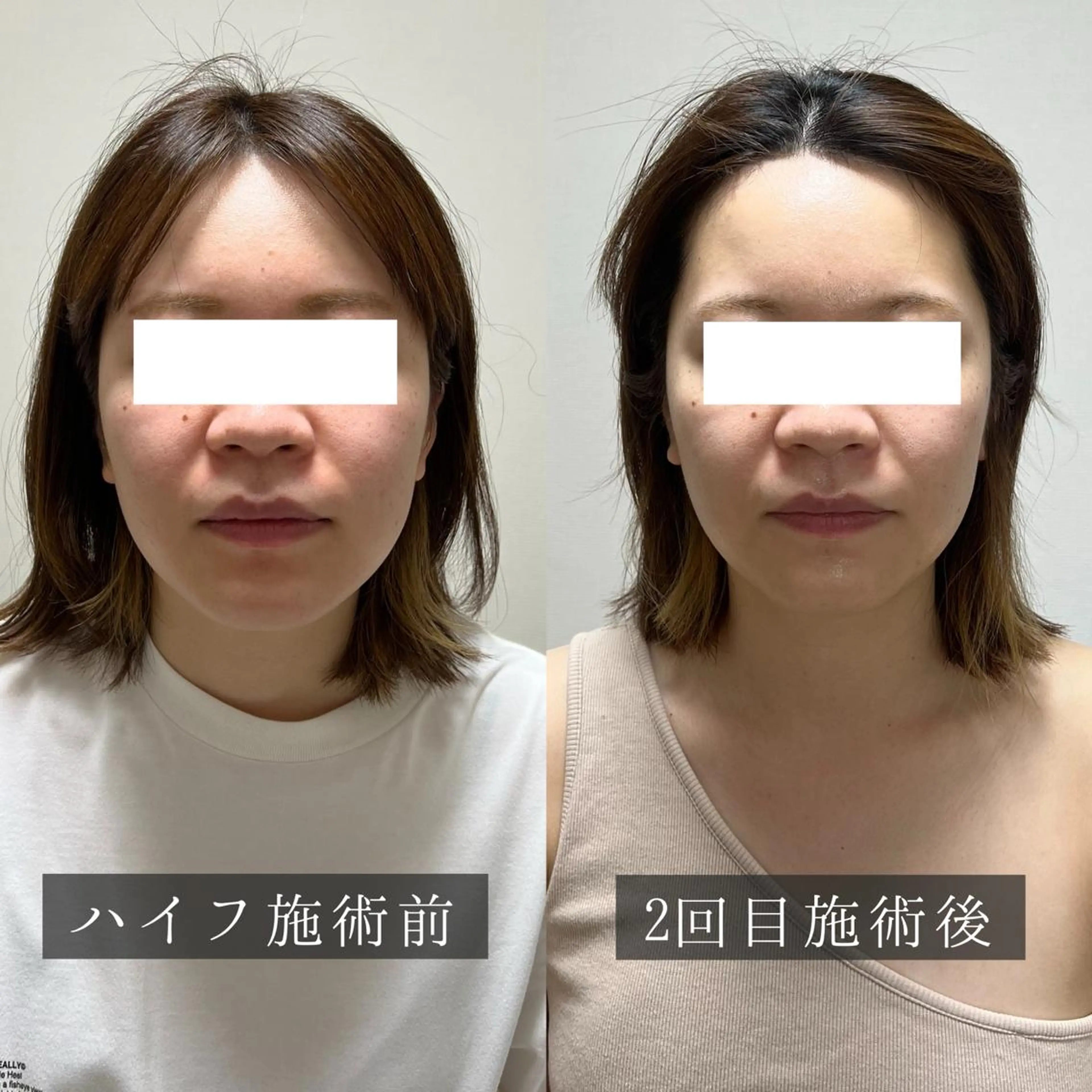 脱毛専門サロン BELFINE恵比寿のエステ・リラクイメージ