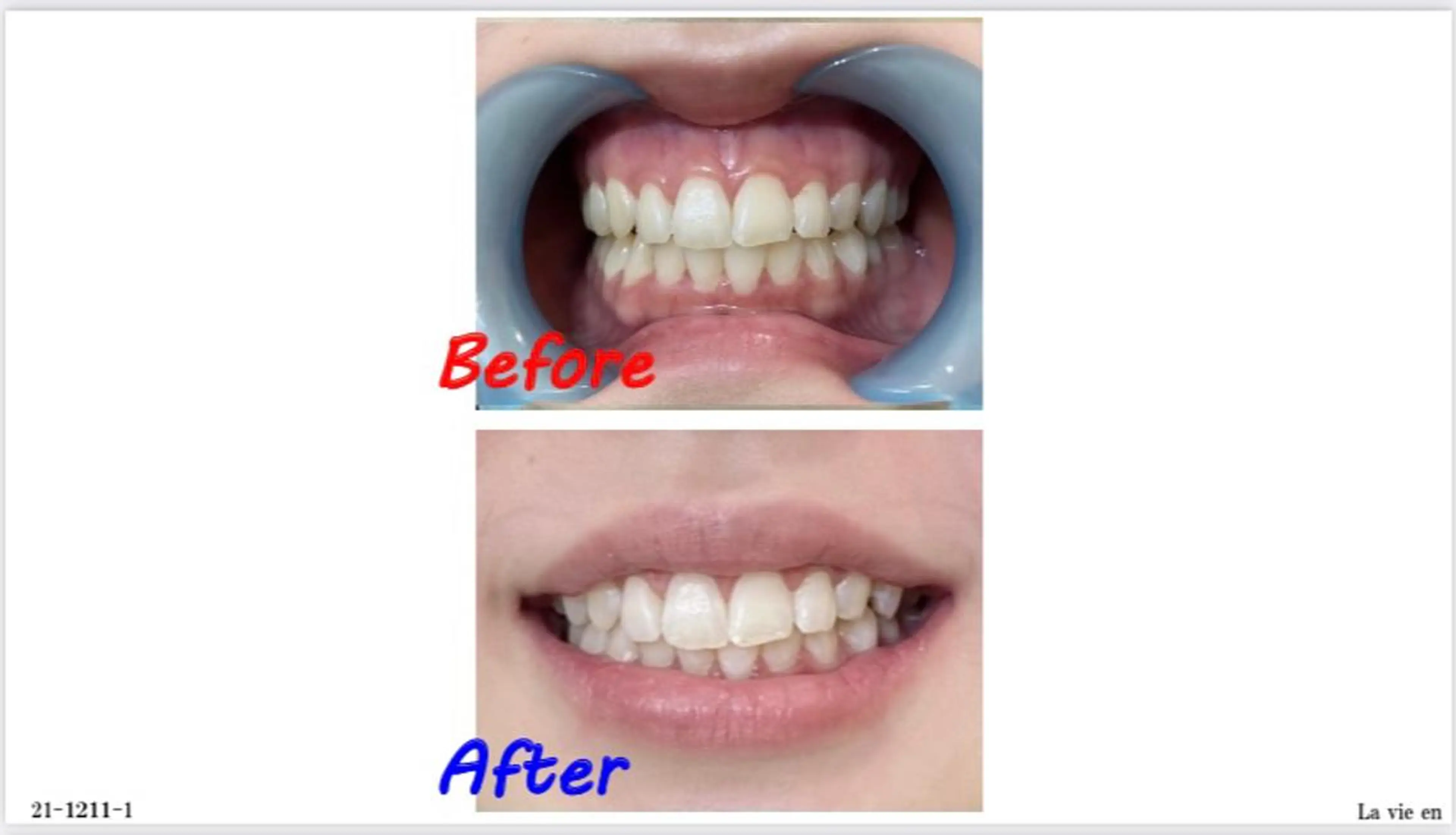 その他 セルフホワイトニングサロン　ラヴィアン所属・ホワイトニングサロン La vie enのその他イメージ