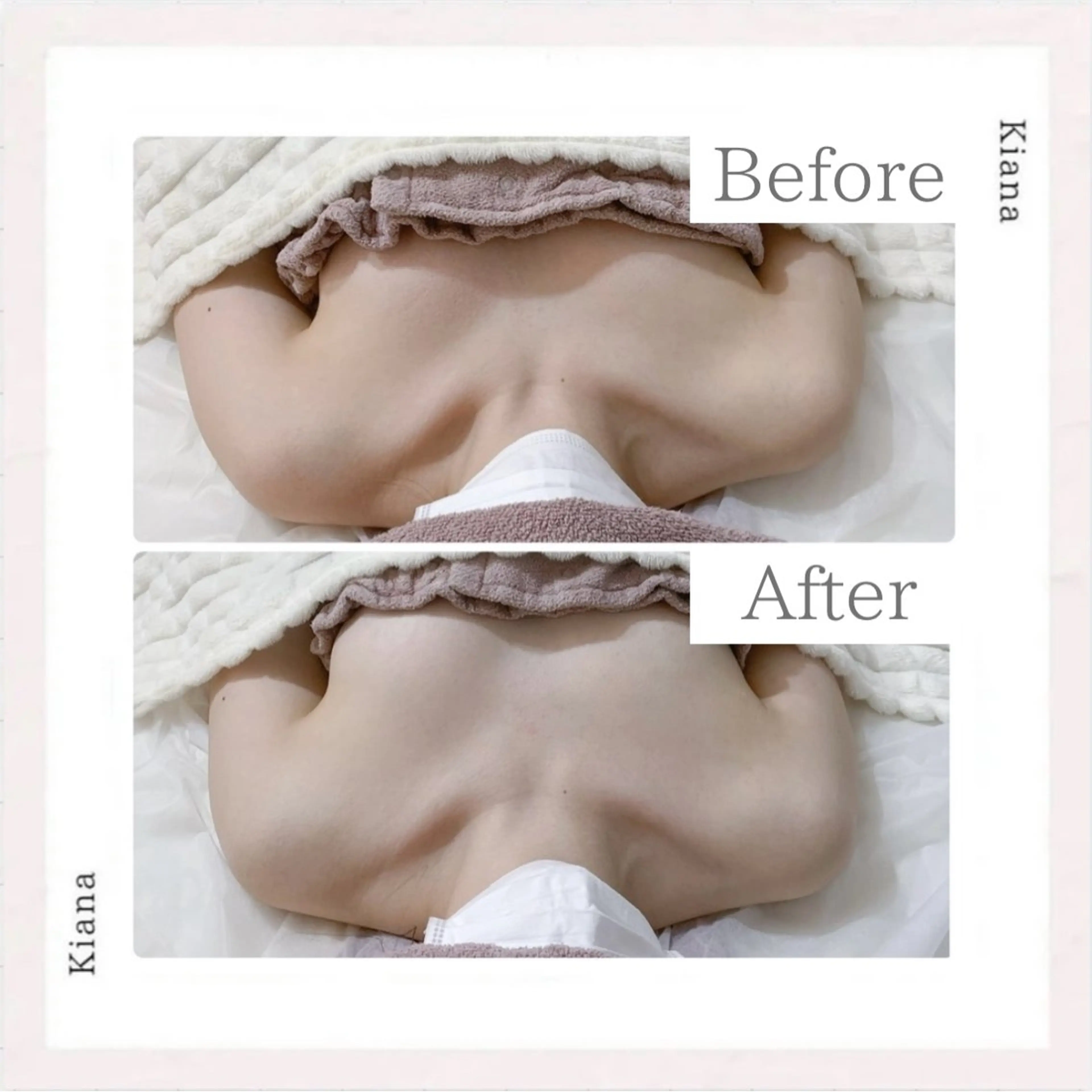 エステ リラク バスト専門Kiana 風のエステ・リラクイメージ