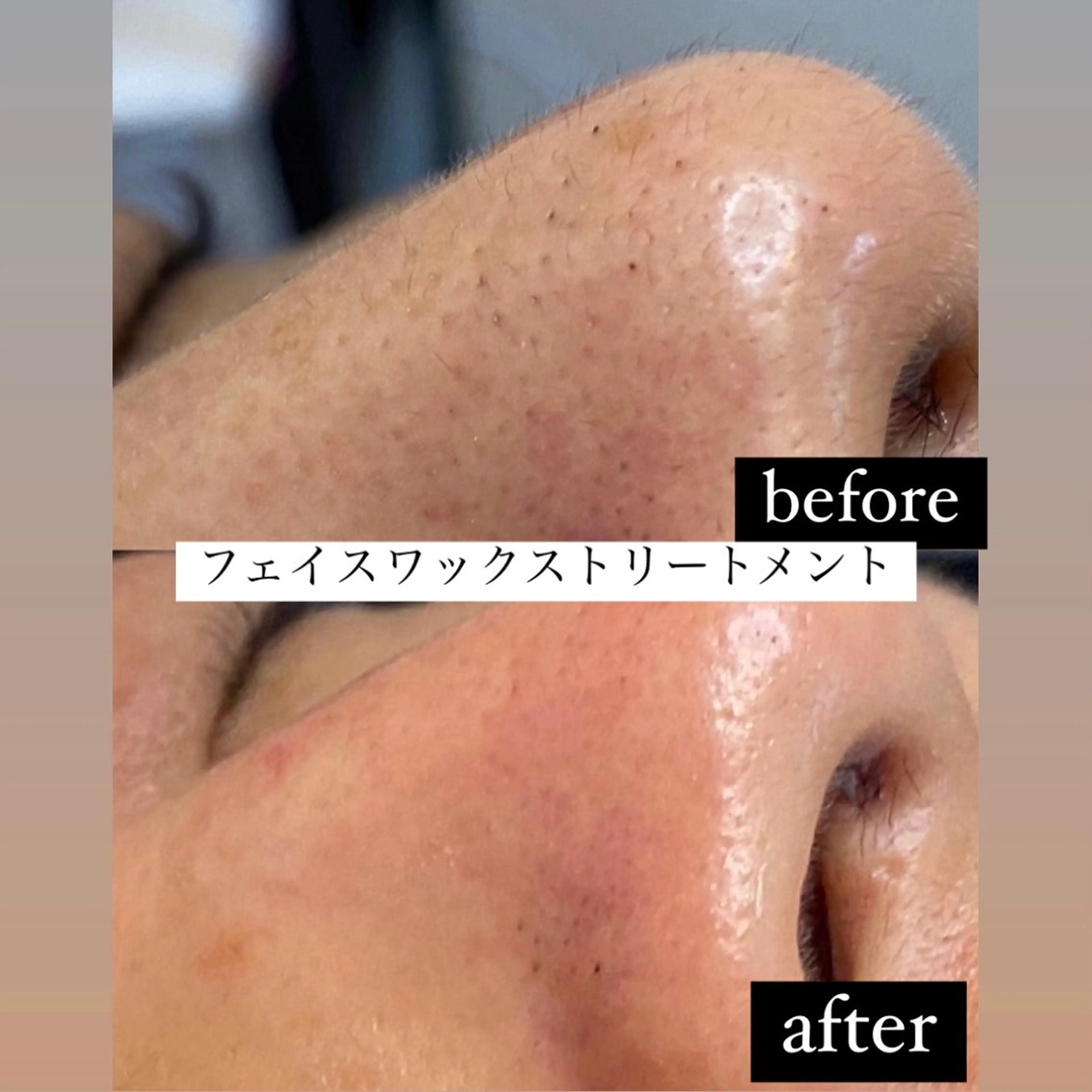 エステ デコパーツが得意♪ ネイル/眉毛/エステの眉毛・アイブロウイメージ