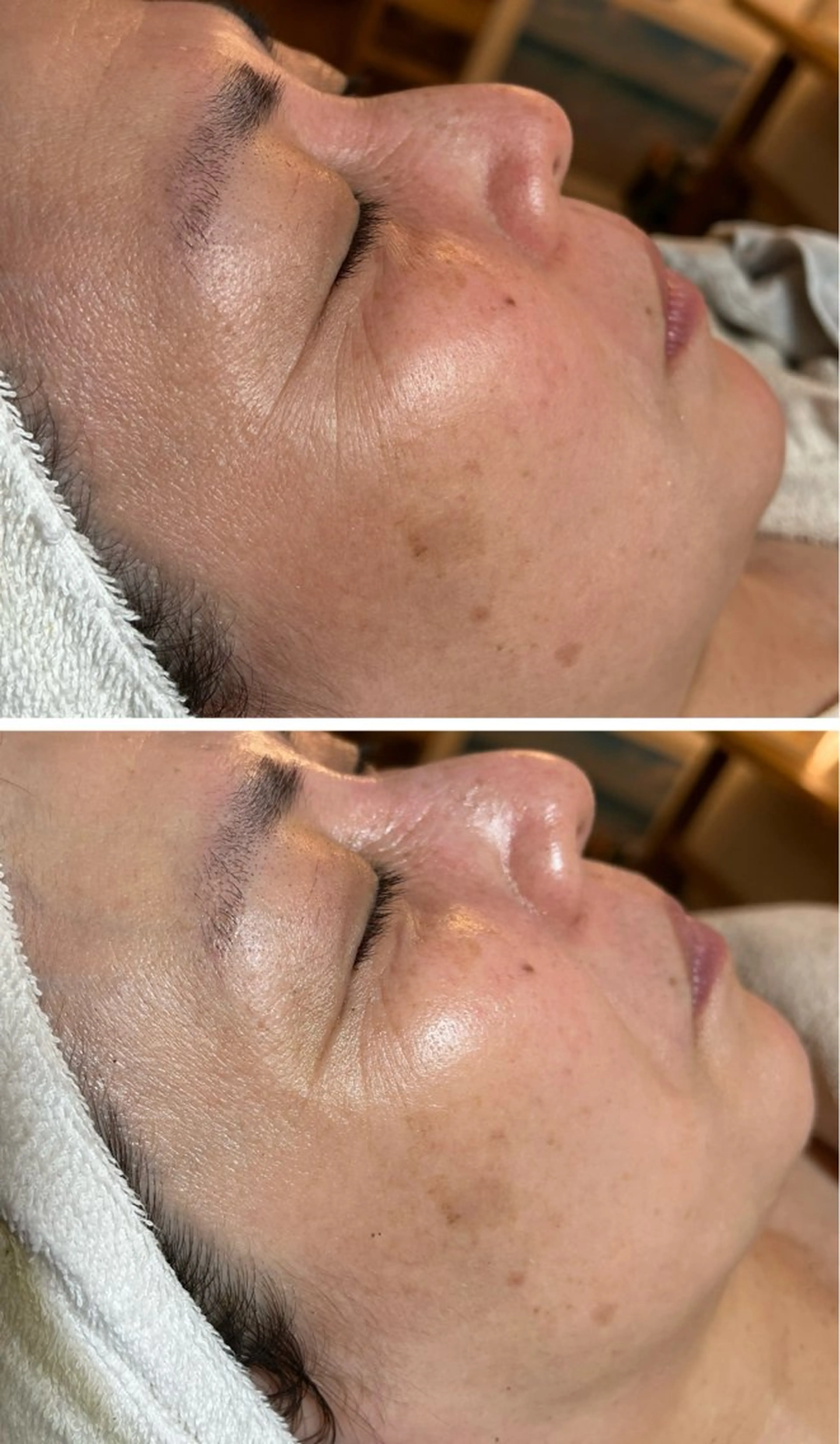 esty hitomiのエステ・リラクイメージ