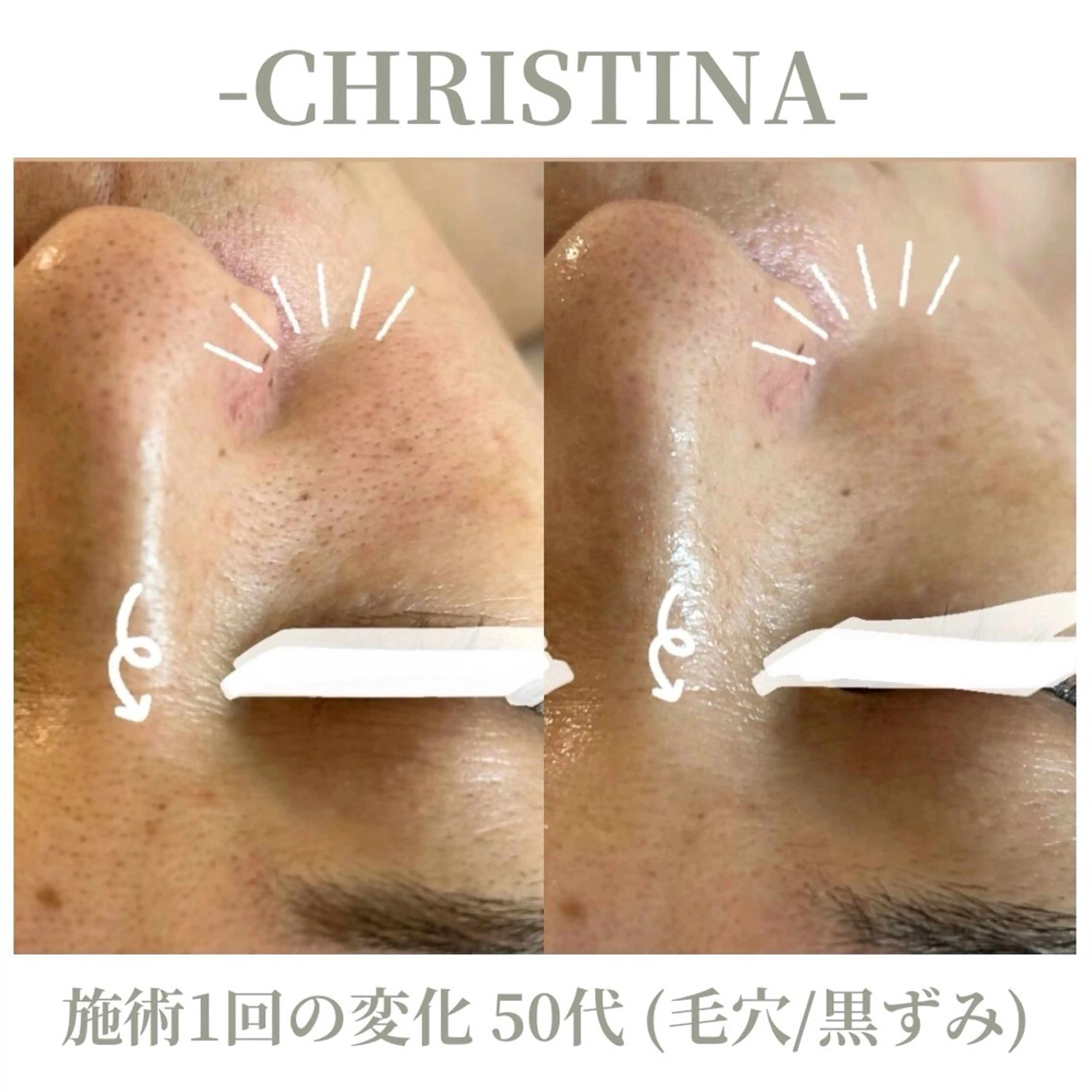 エステ 肌質改善|天王寺 For...はるかのエステ・リラクイメージ