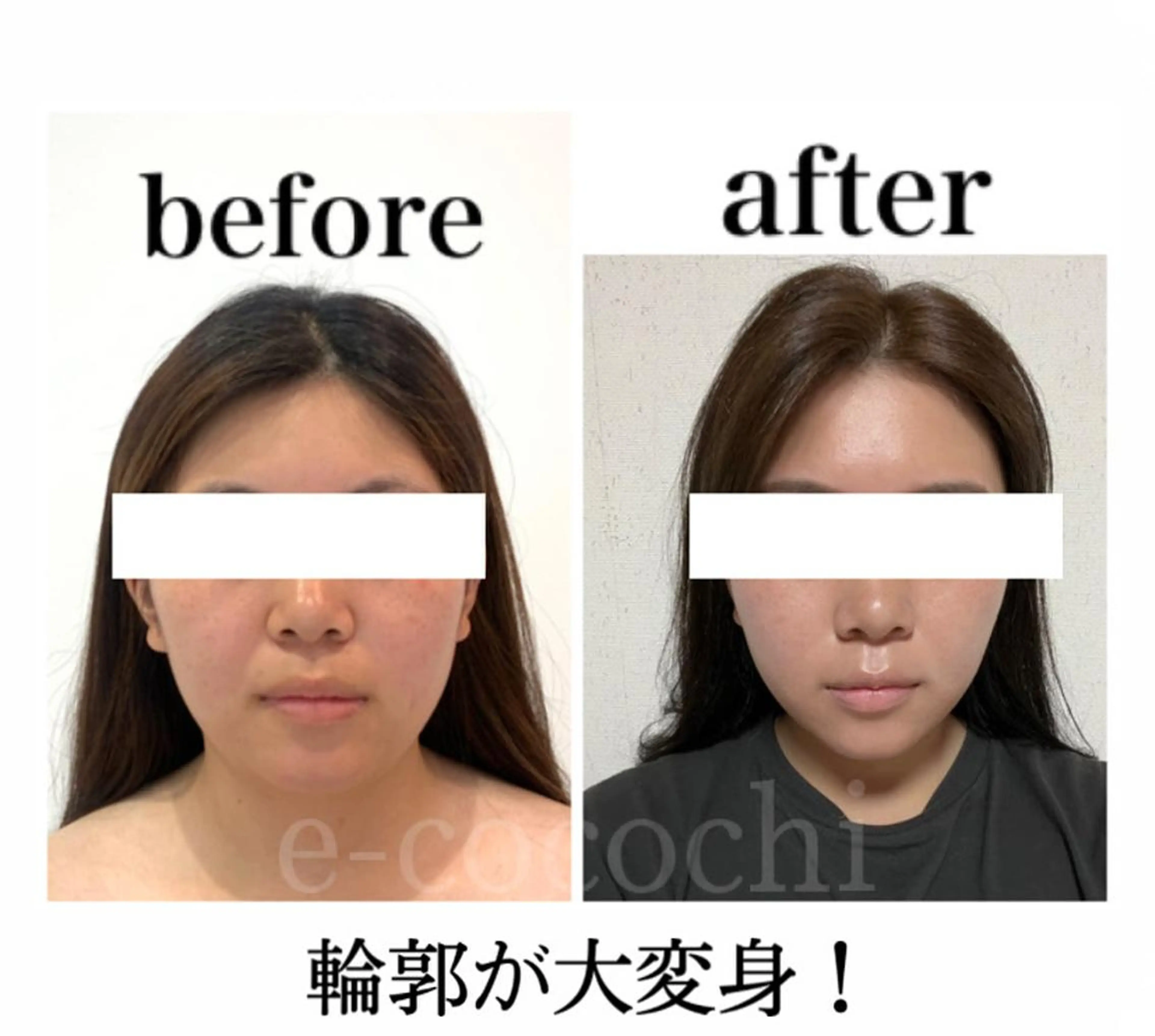 エステ リラク 小顔と ヘッドスパのお店のエステ・リラクイメージ