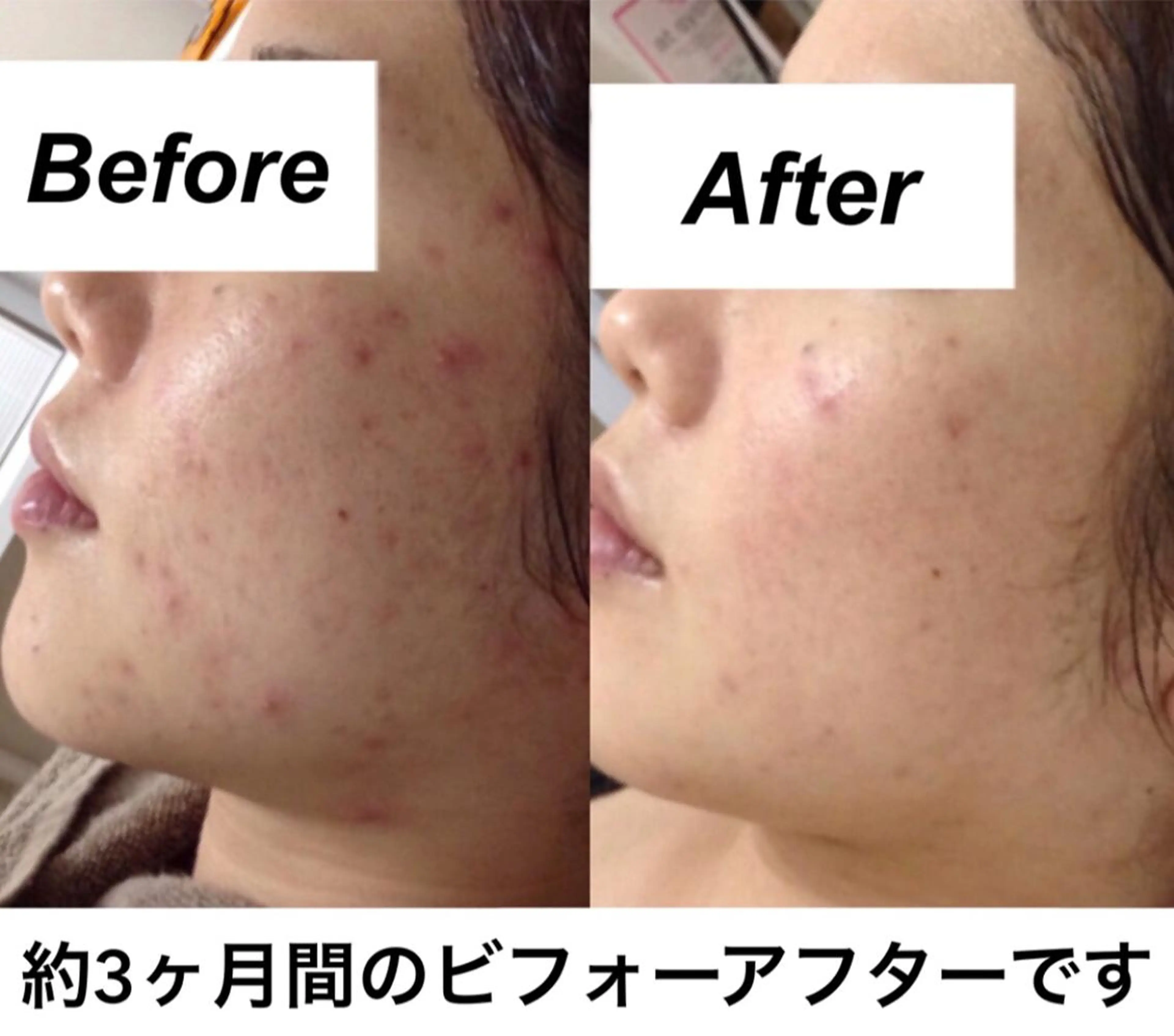 エステ リラク 都度払い肌質改善 &脱毛Blancheのエステ・リラクイメージ