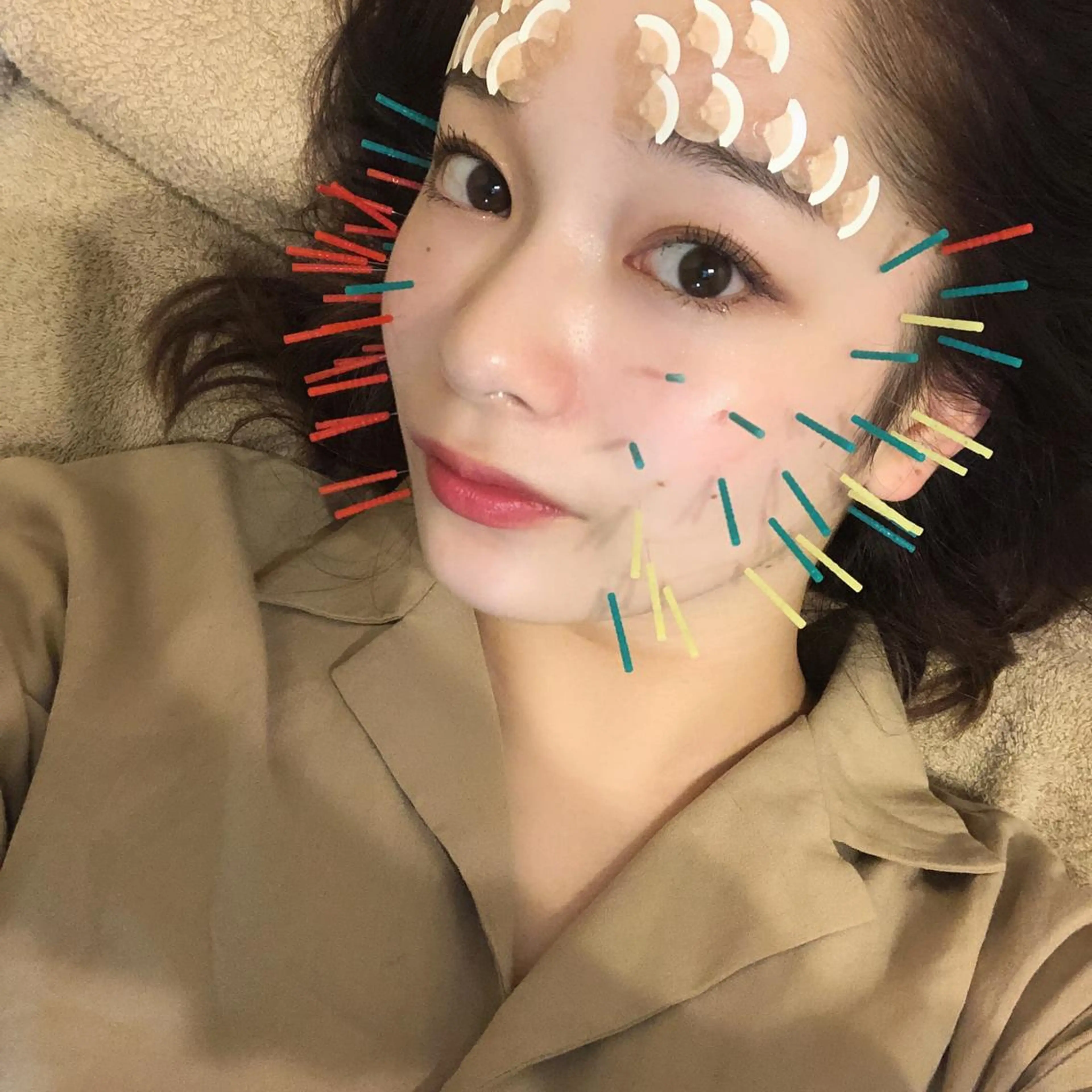 鍼灸整骨院Refine所属・鍼灸 Refineのその他イメージ