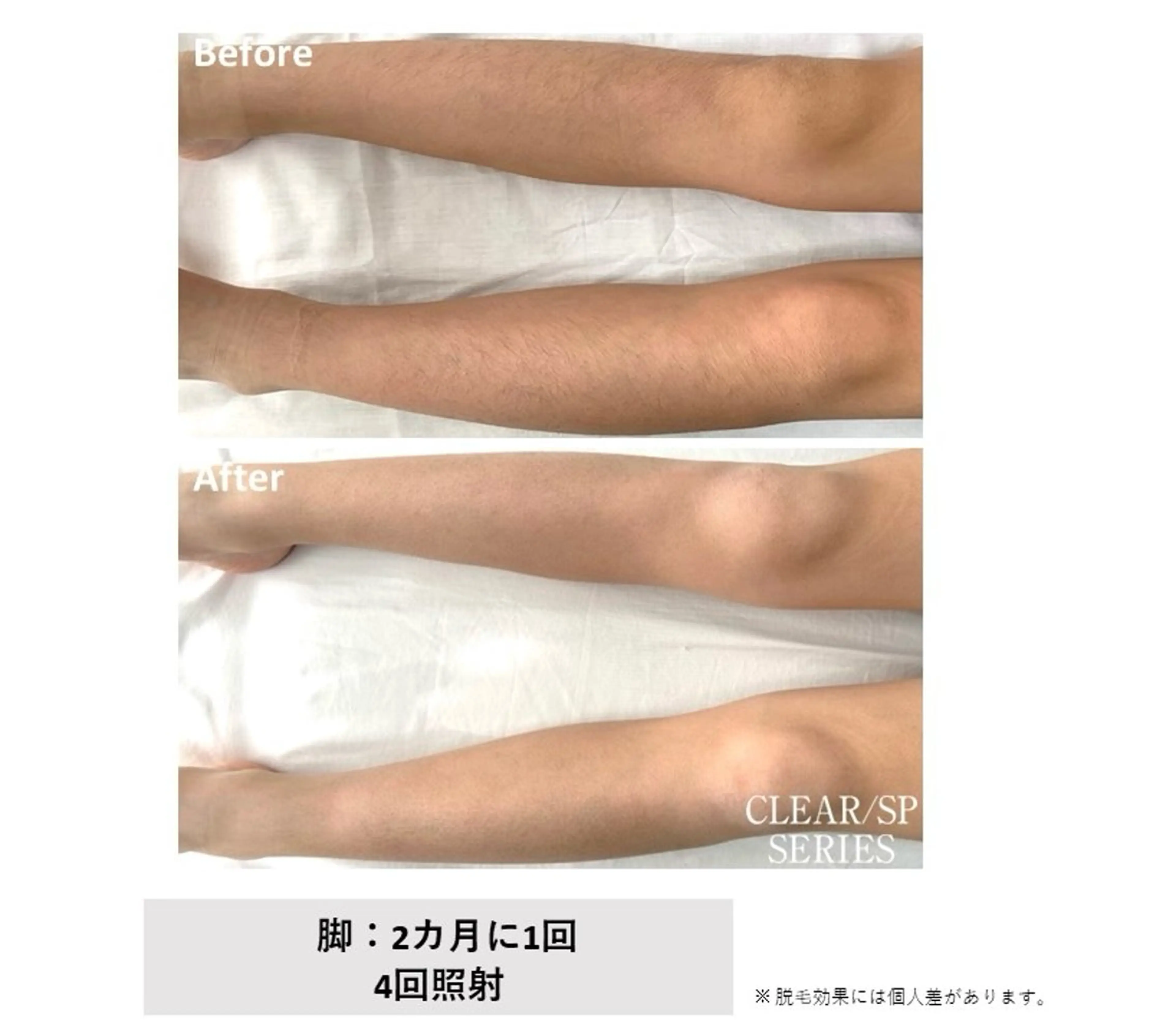 脱毛 E'clat Kanaのエステ・リラクイメージ