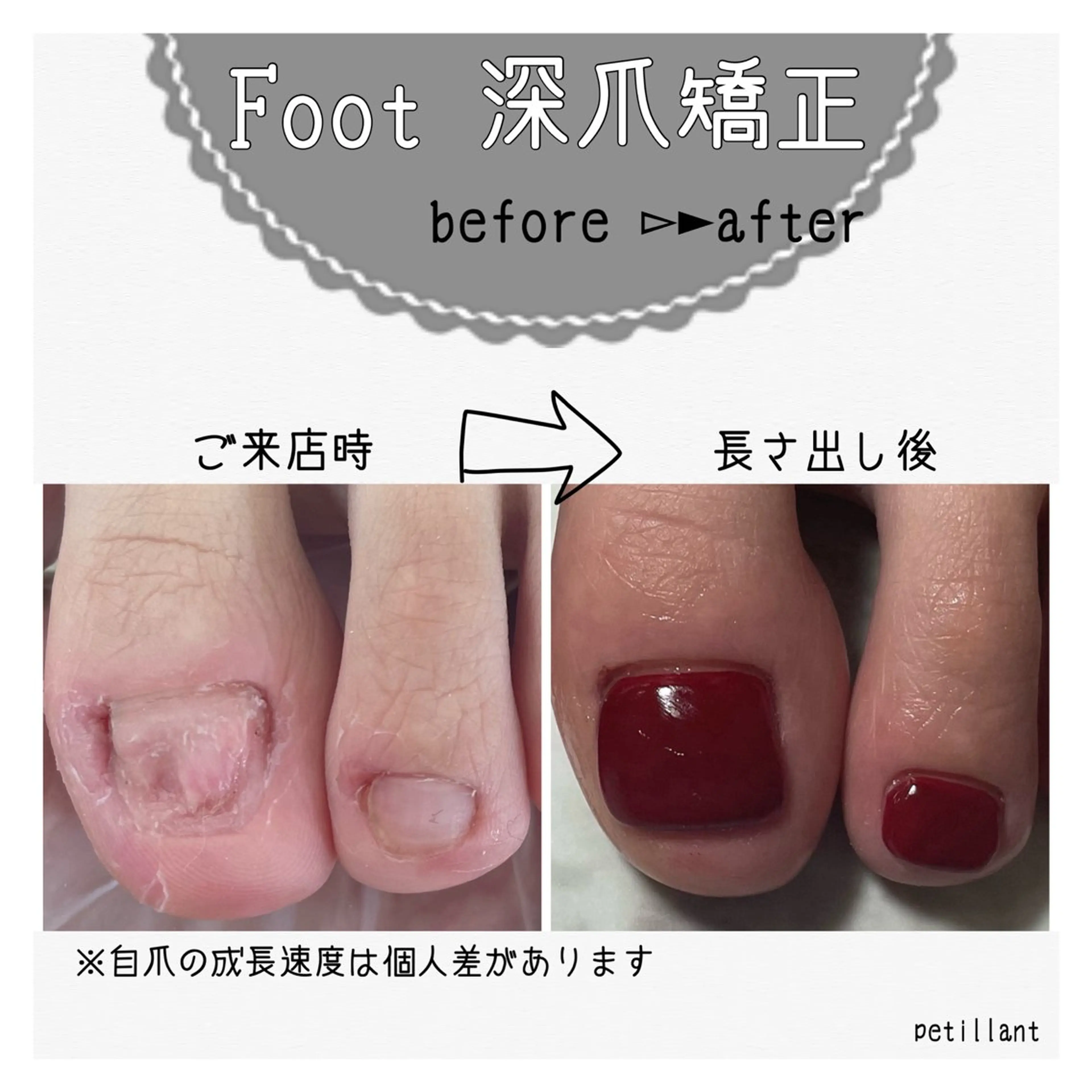 ネイル ボルドー フットネイル ワンカラーネイル petillant所属・nail salon petillantのネイルデザイン