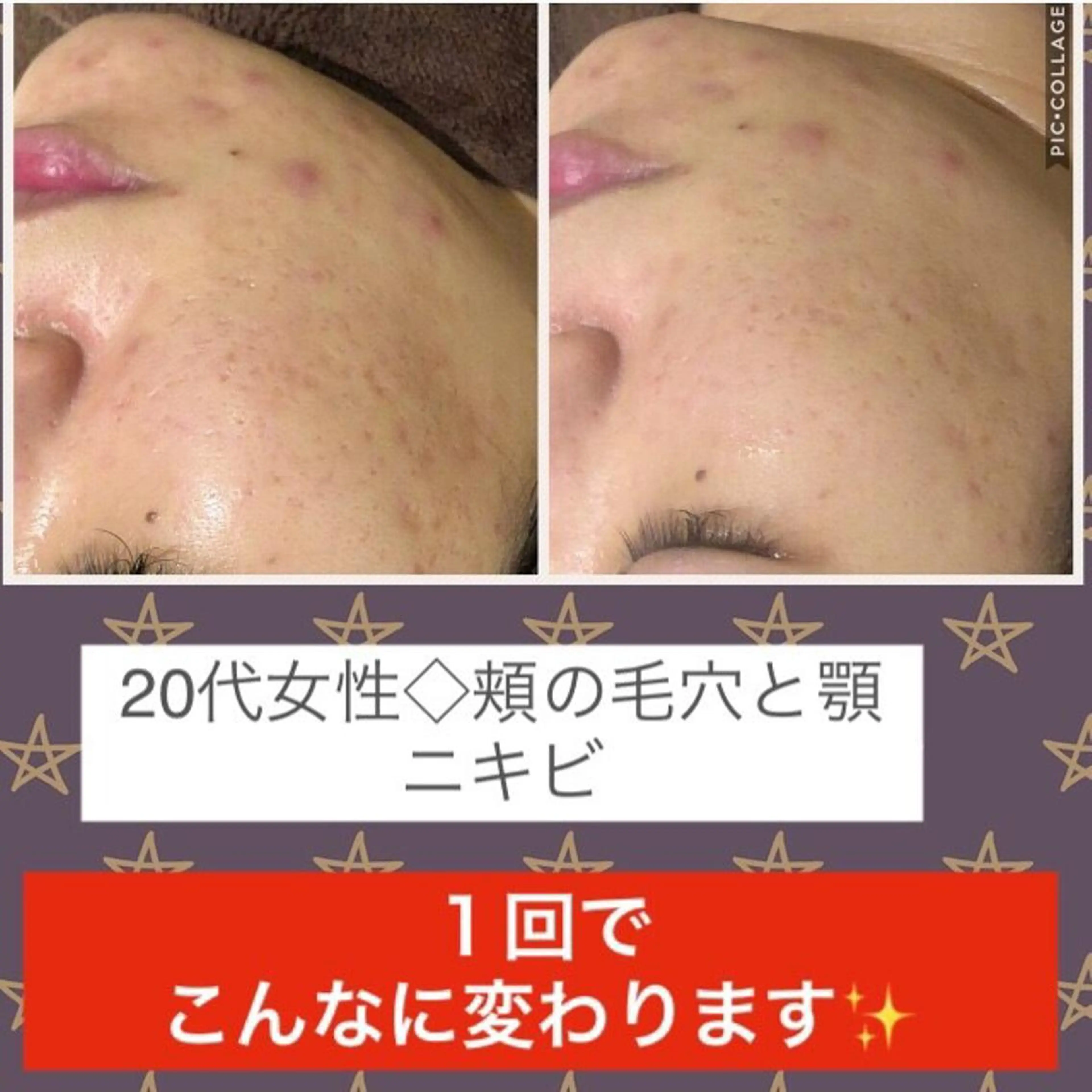 ミディアム カラー パーマ ヘアアレンジ メンズ キッズ ネイル マツエク・マツパ アクール　齋藤 ♡肌トラブル卒業のエステ・リラクイメージ