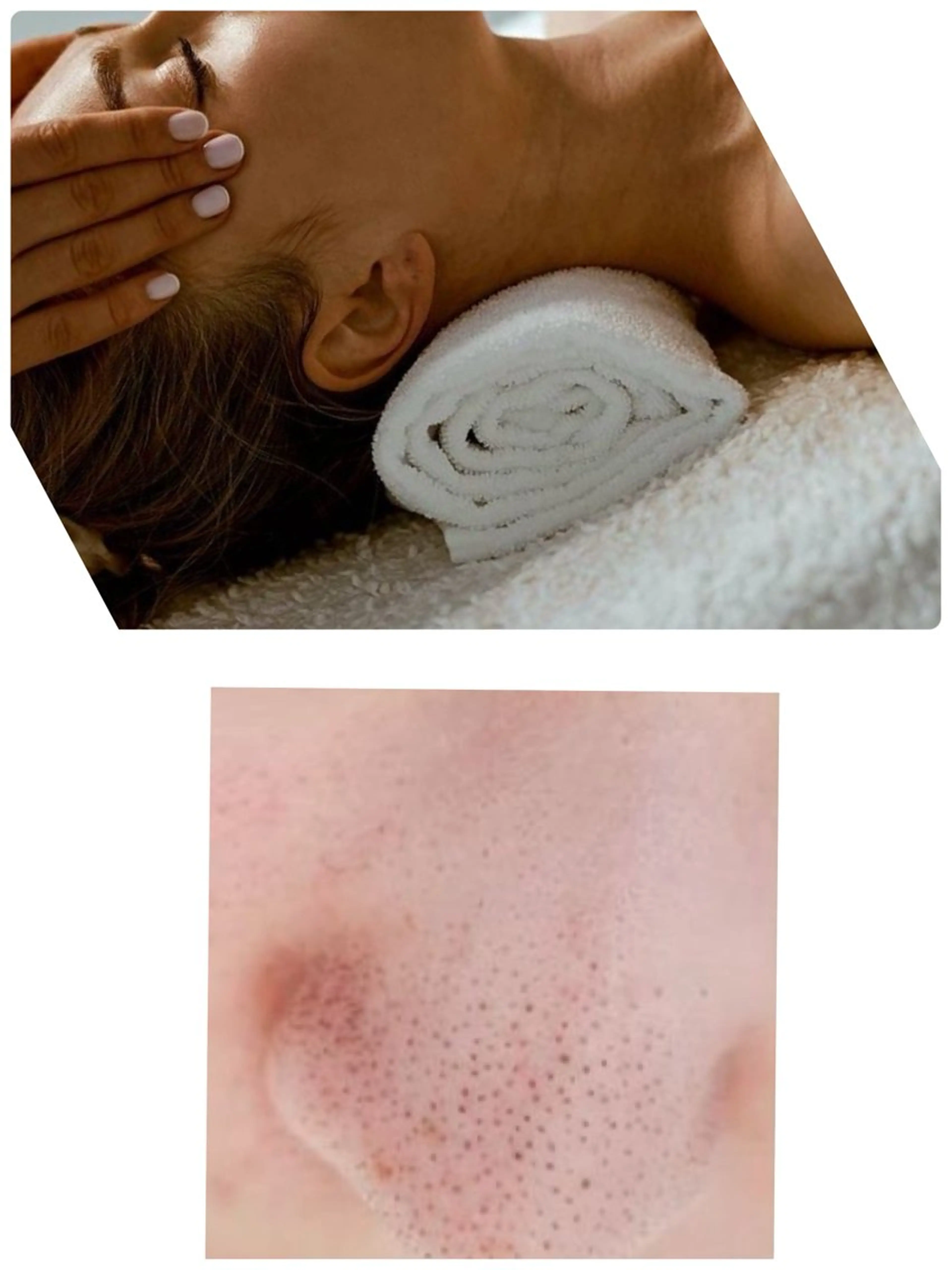 鼻の黒ずみ角栓除去クレンジングモデルの写真