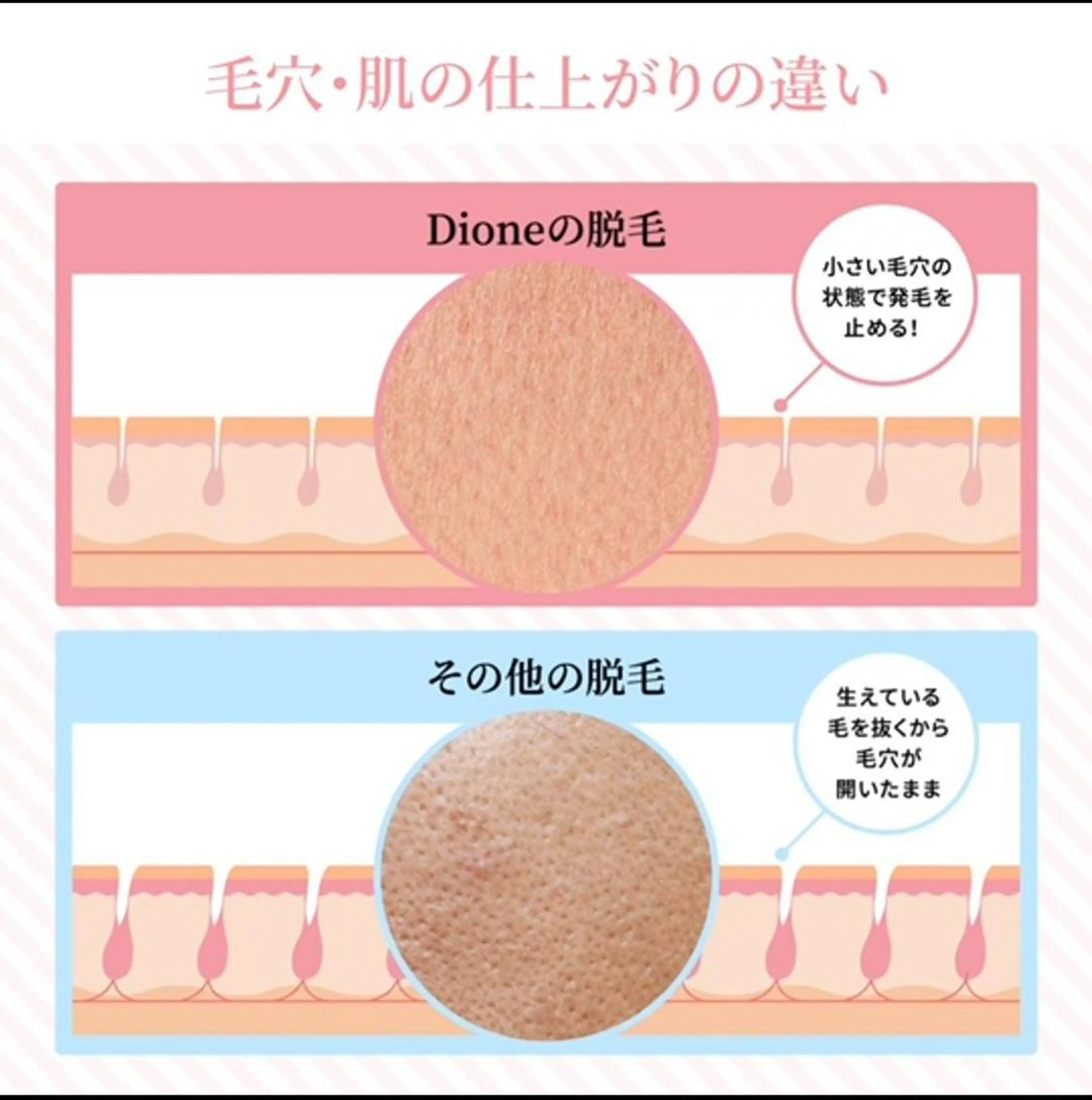 脱毛 Dione八王子店所属・Dione 八王子店のエステ・リラクイメージ