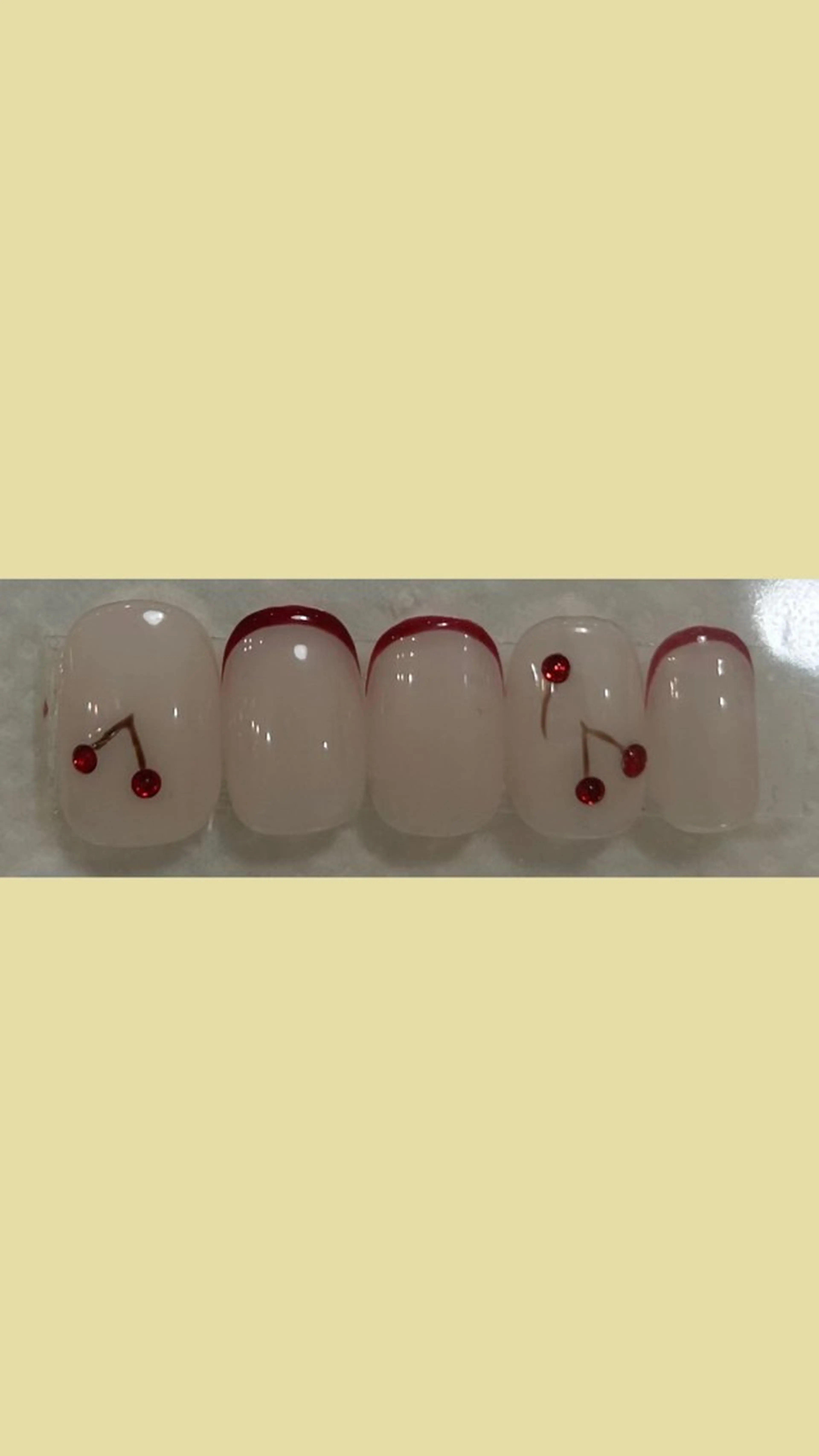 【ソフトジェルオフ有】SSコースの写真