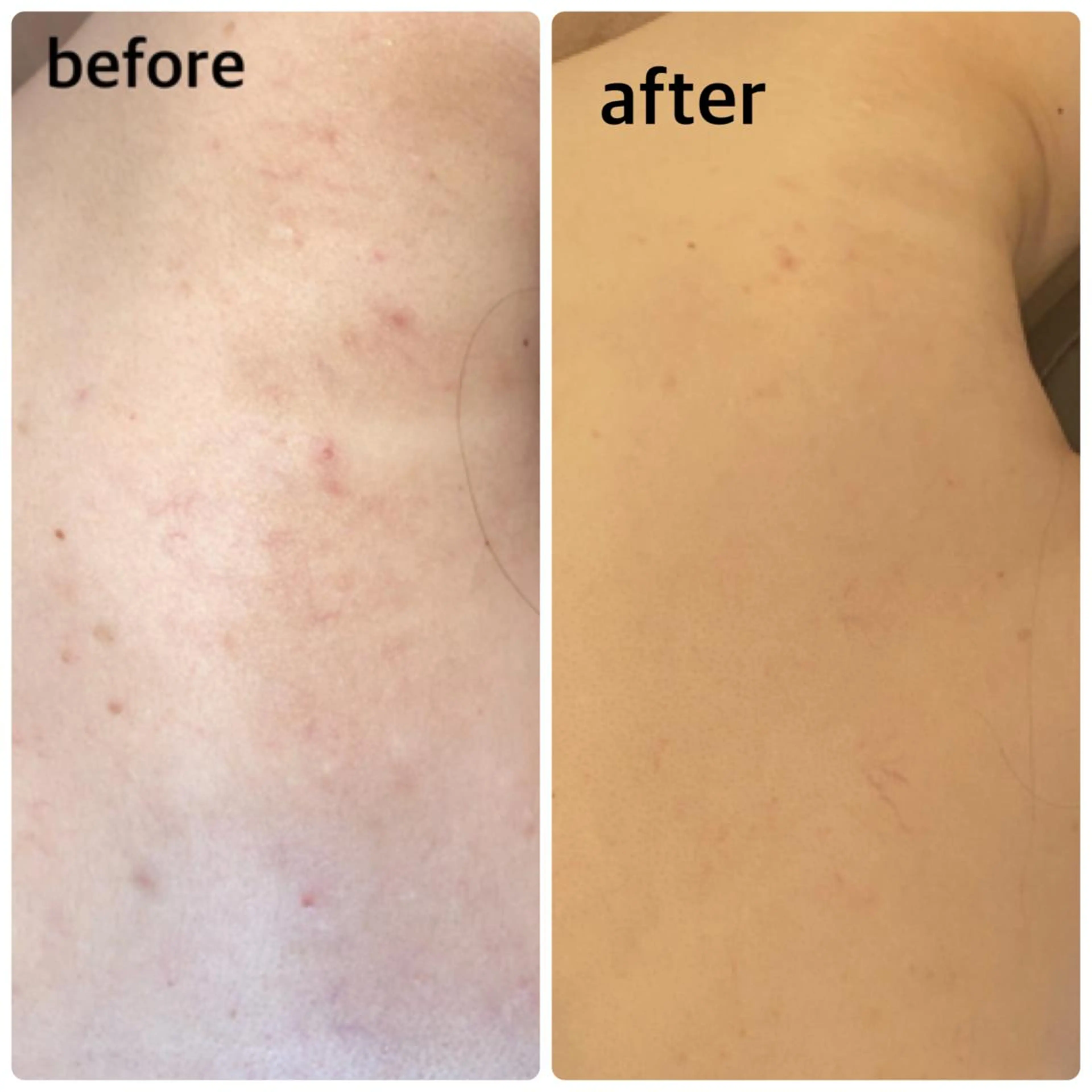 FLEUR大阪・整体 ・ハイフ・痩身・小顔のエステ・リラクイメージ