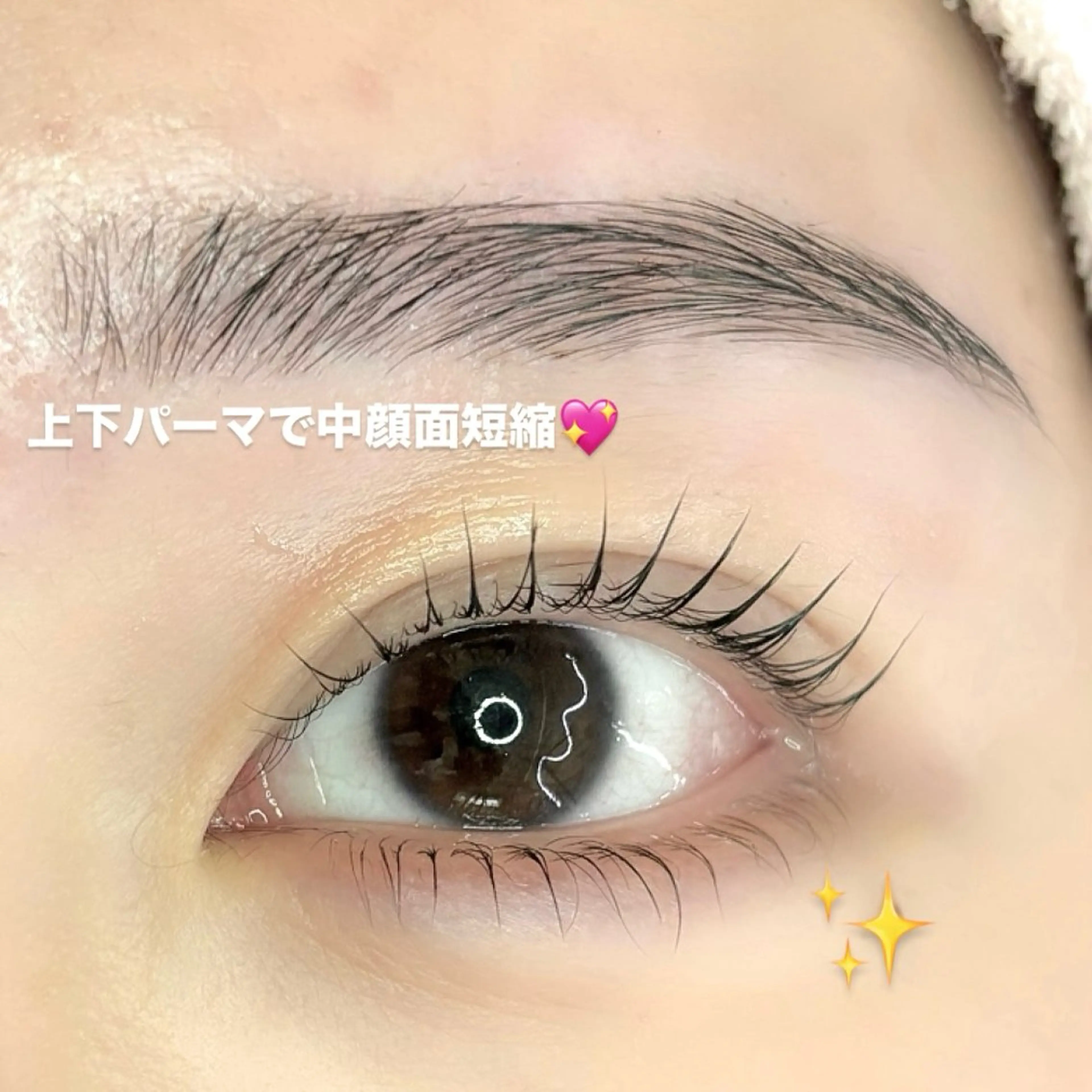 上下まつ毛パーマ🎀中顔面短縮⭐️の写真