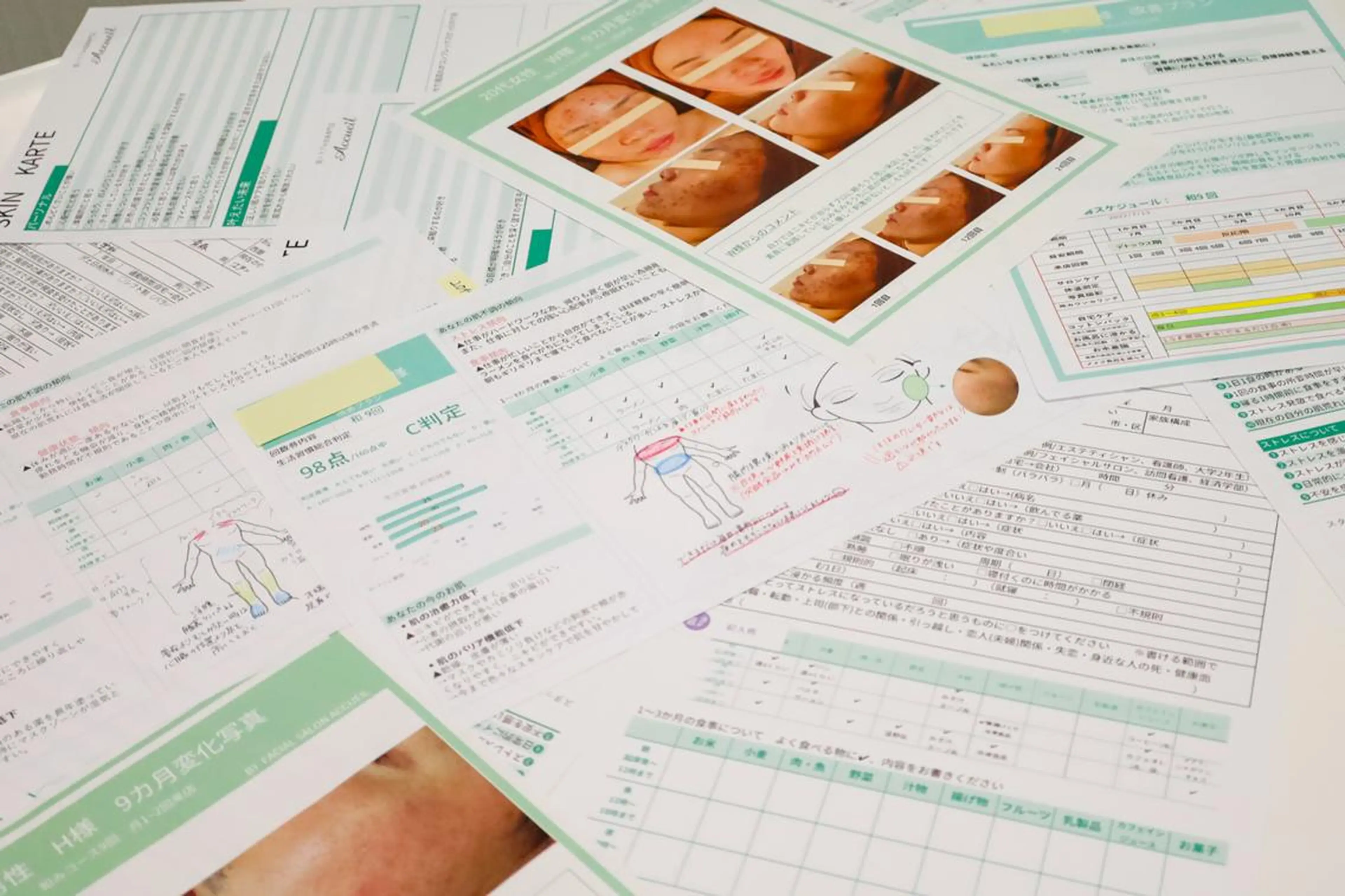 🔥3か月で肌革命 🔥ニキビ専門店のエステ・リラクイメージ