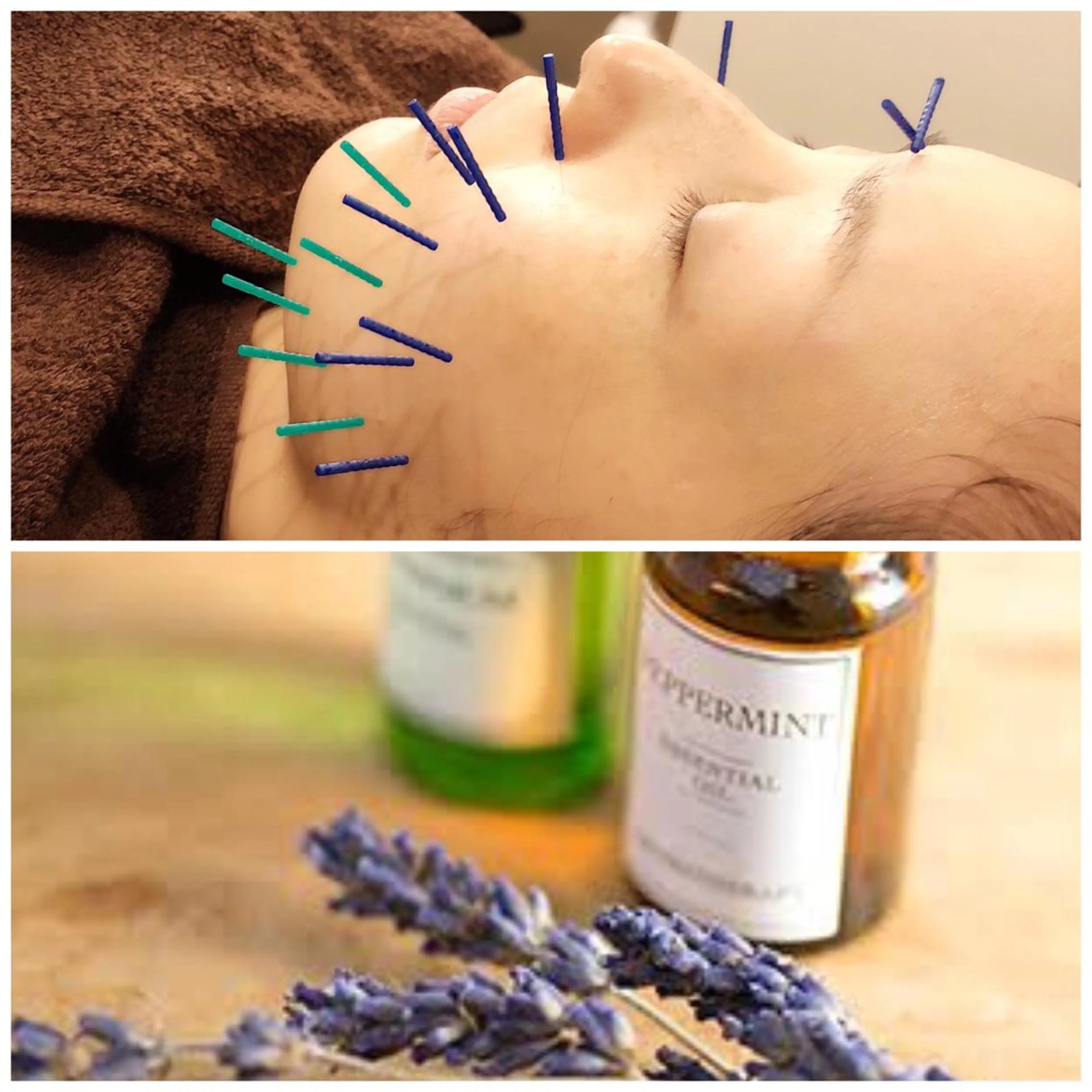 美容鍼灸女性専用 りんご鍼灸治療院のその他イメージ