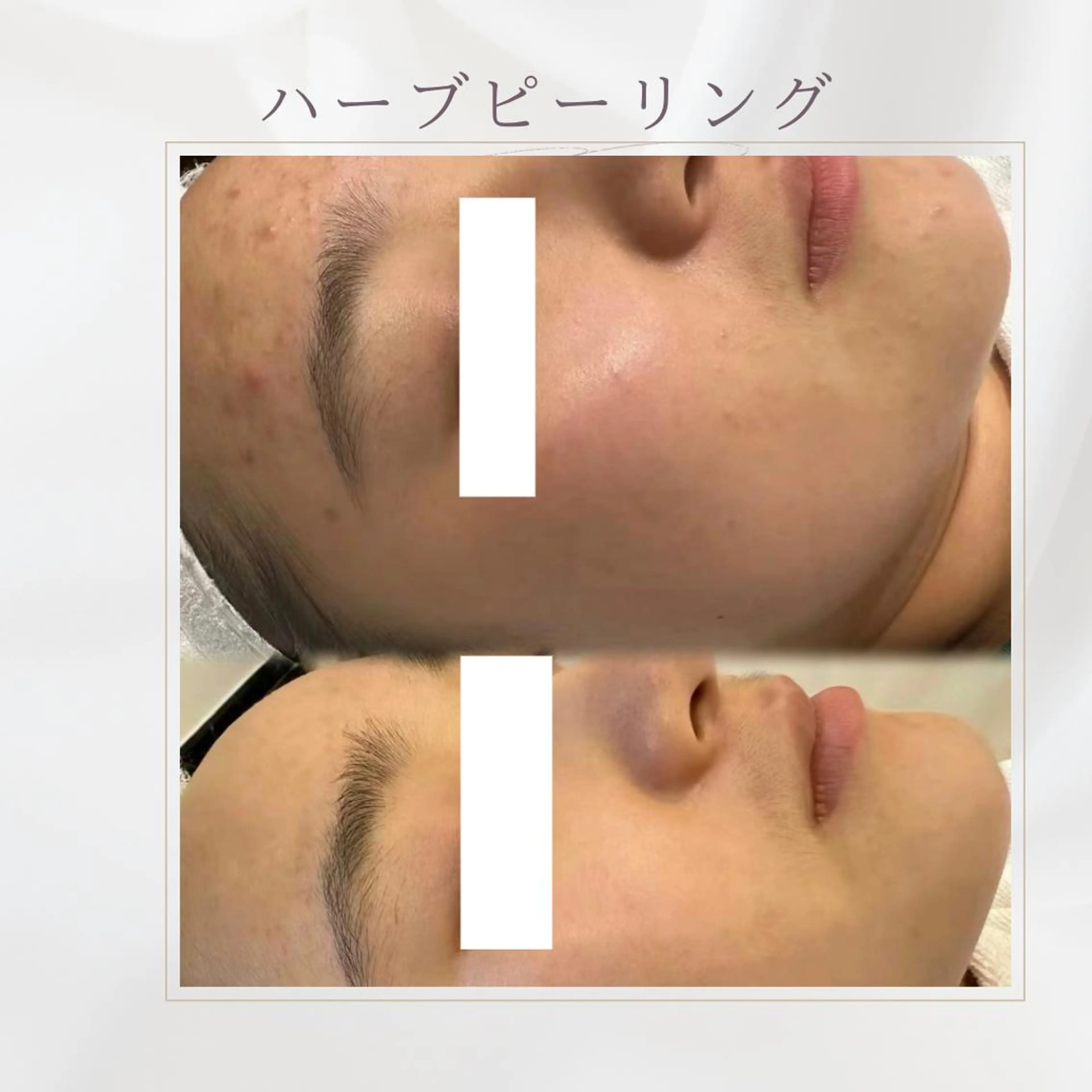 美肌小顔&痩身 MITUREI九条店のエステ・リラクイメージ